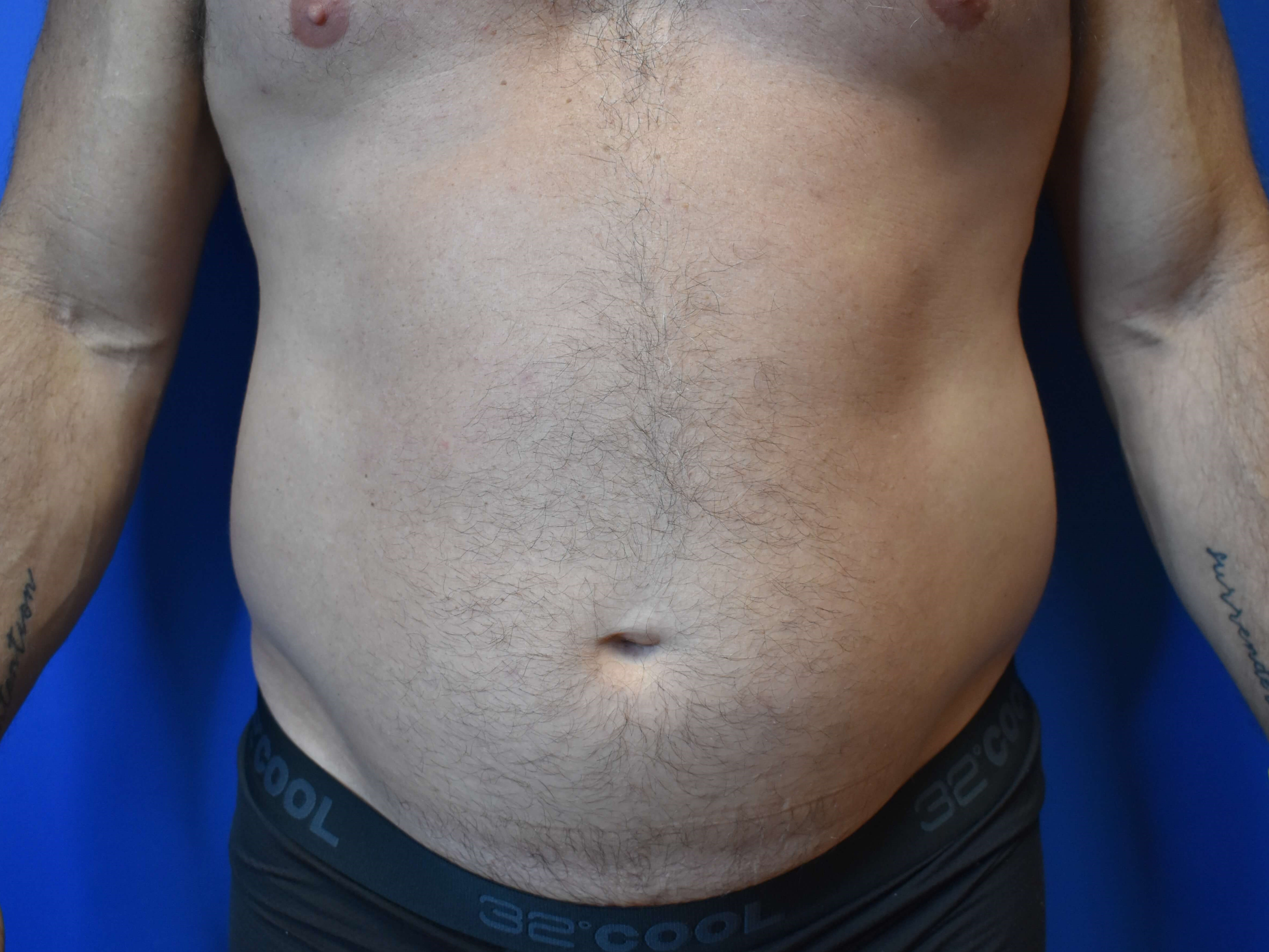 Before Image