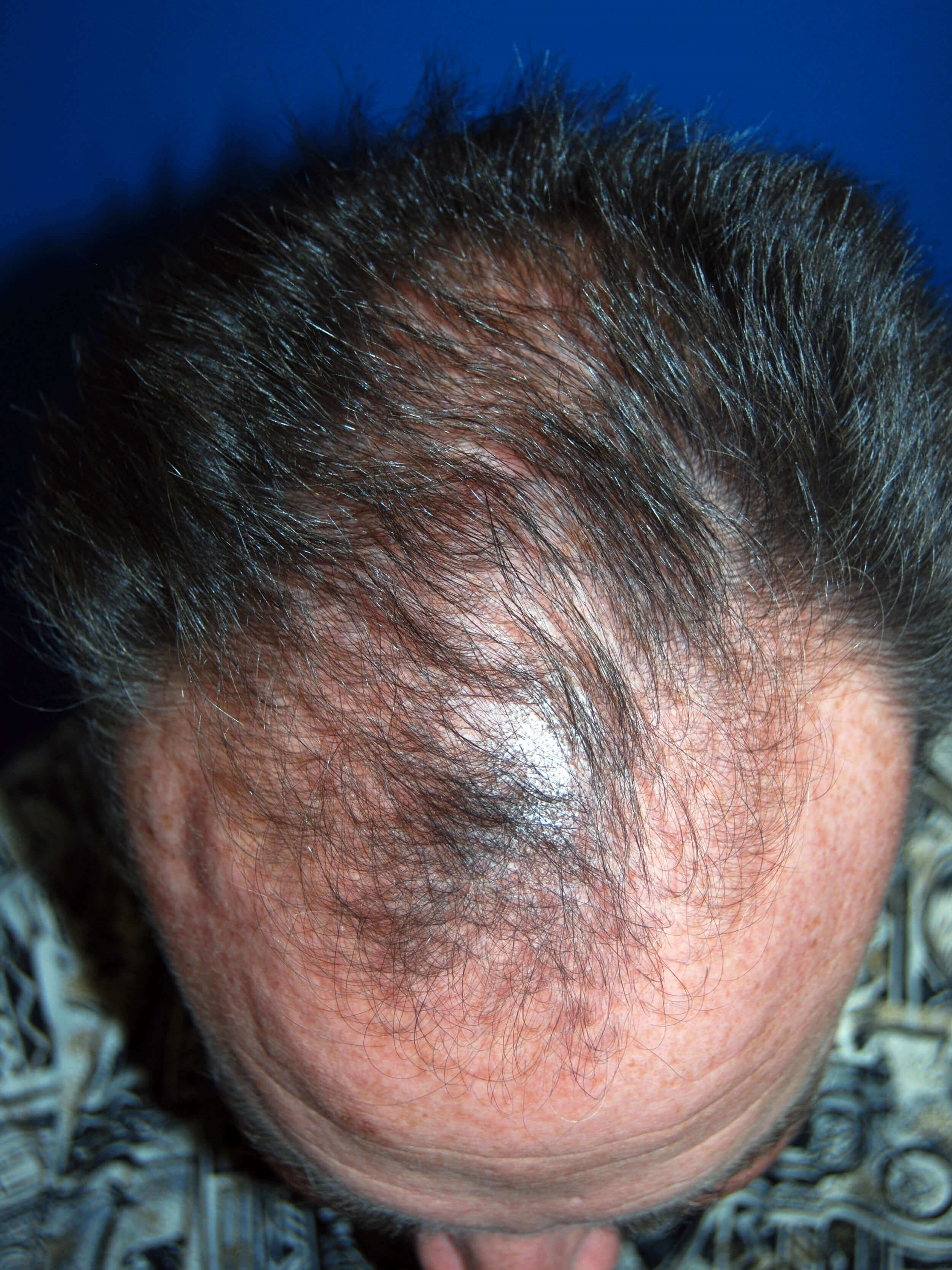 Before Image