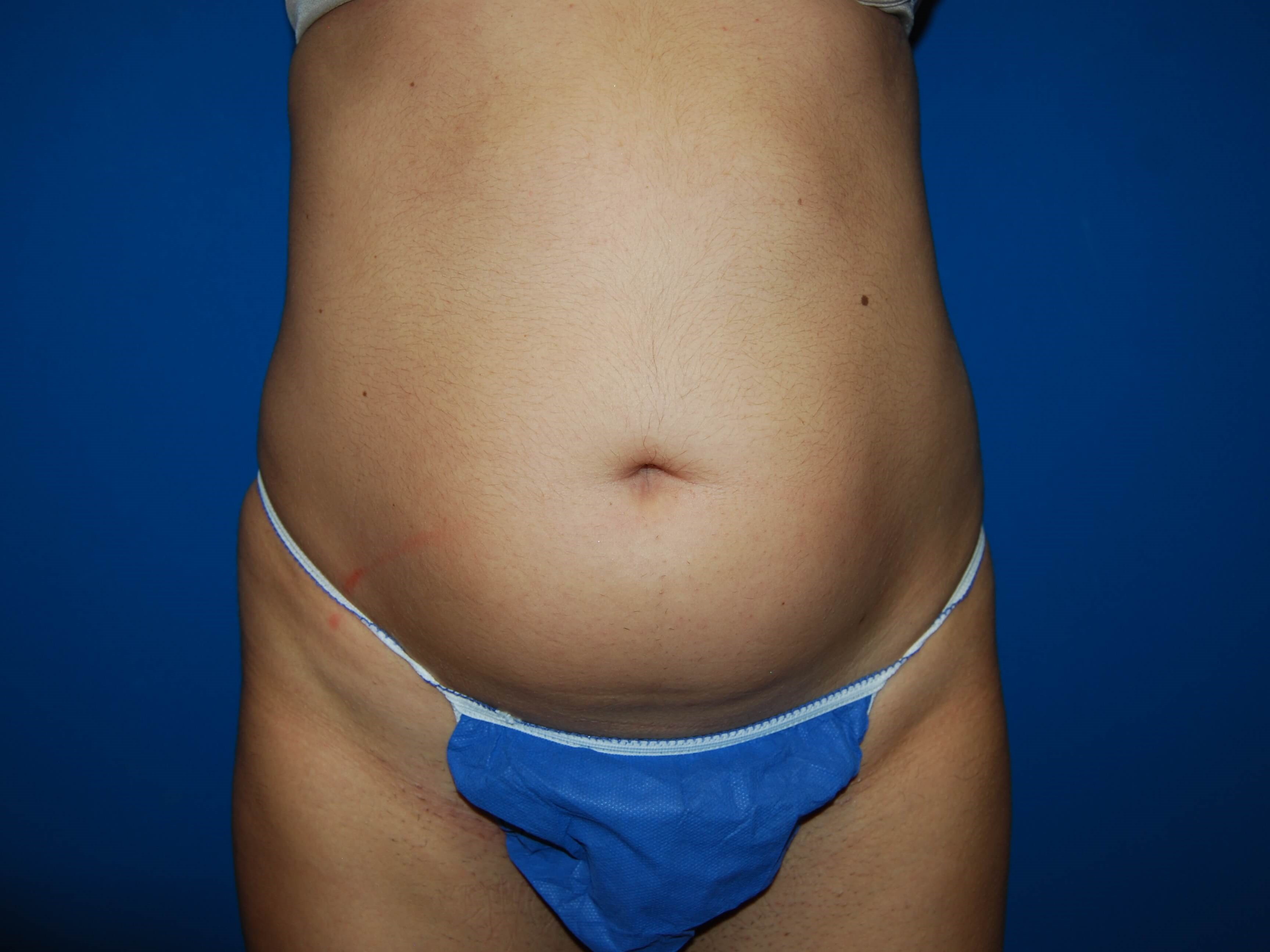 Before Image