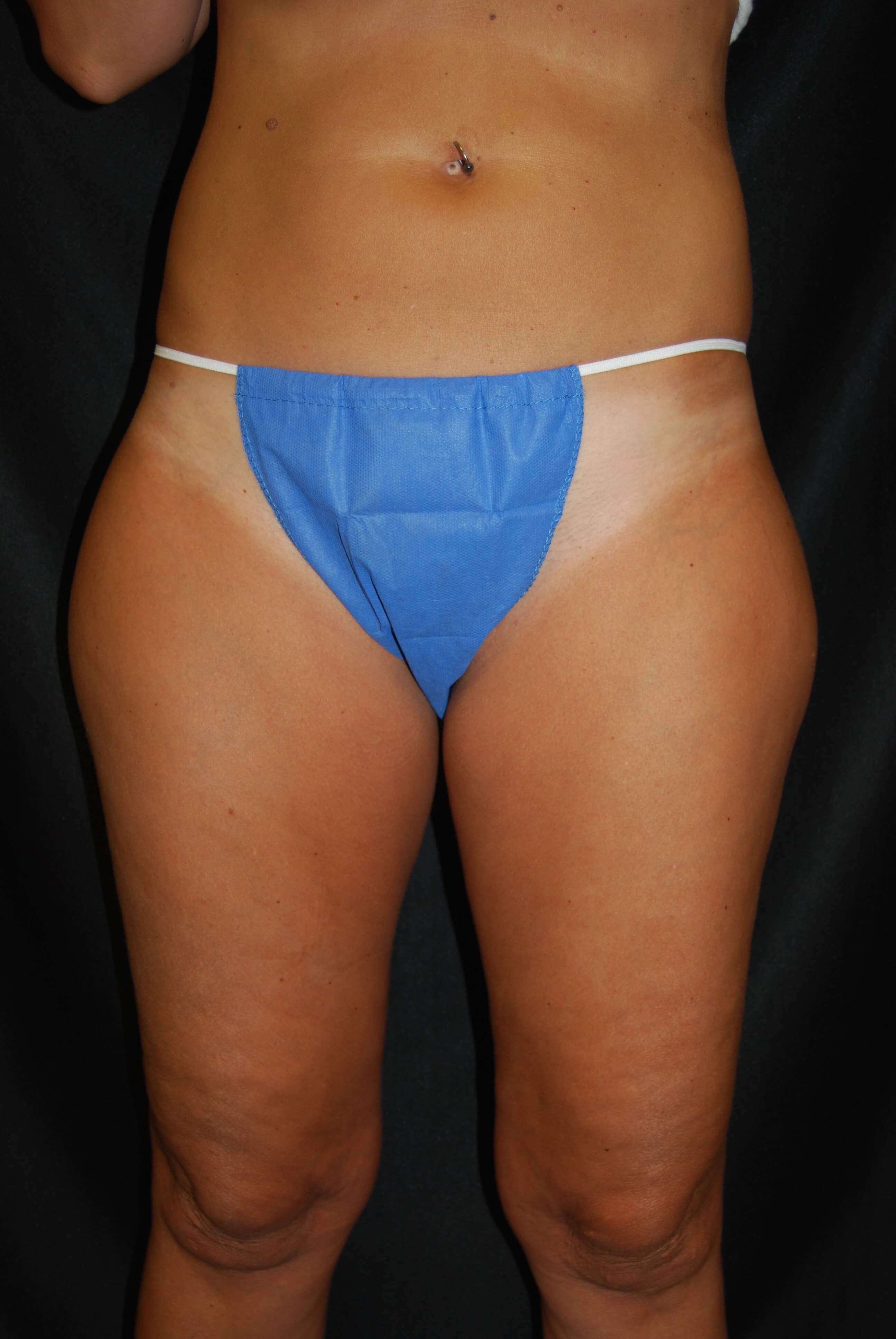 Before Image