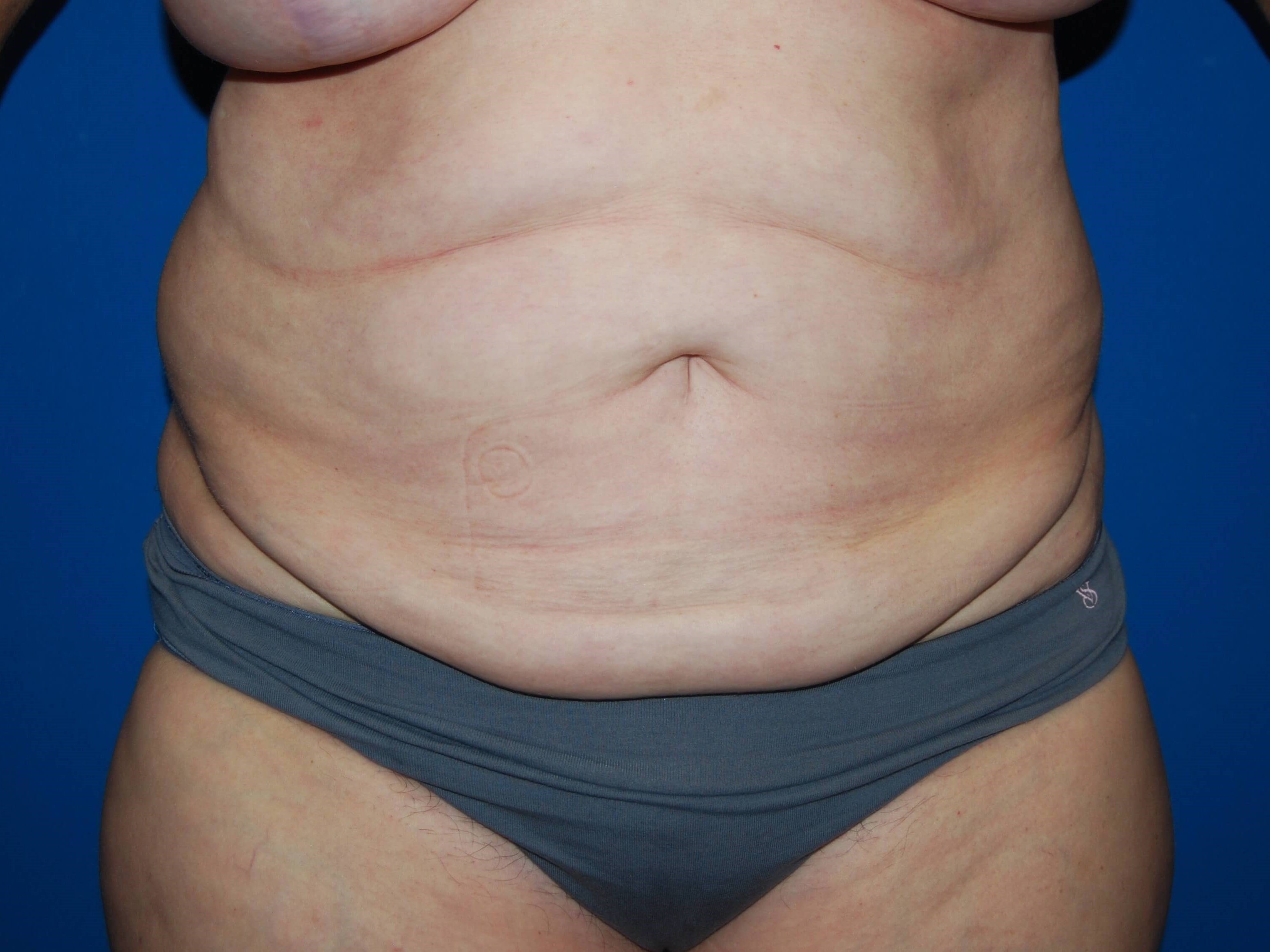 Before Image
