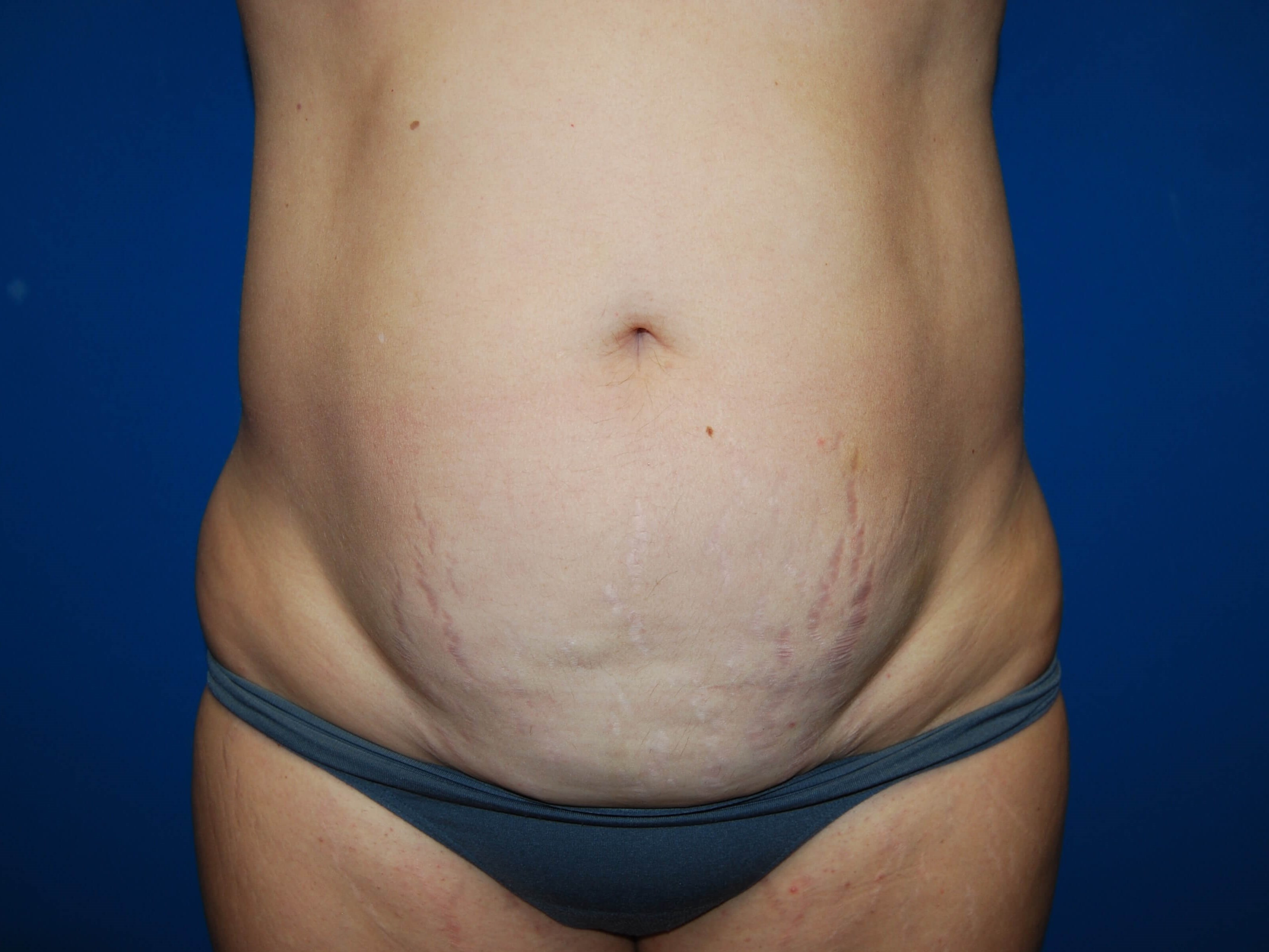 Before Image