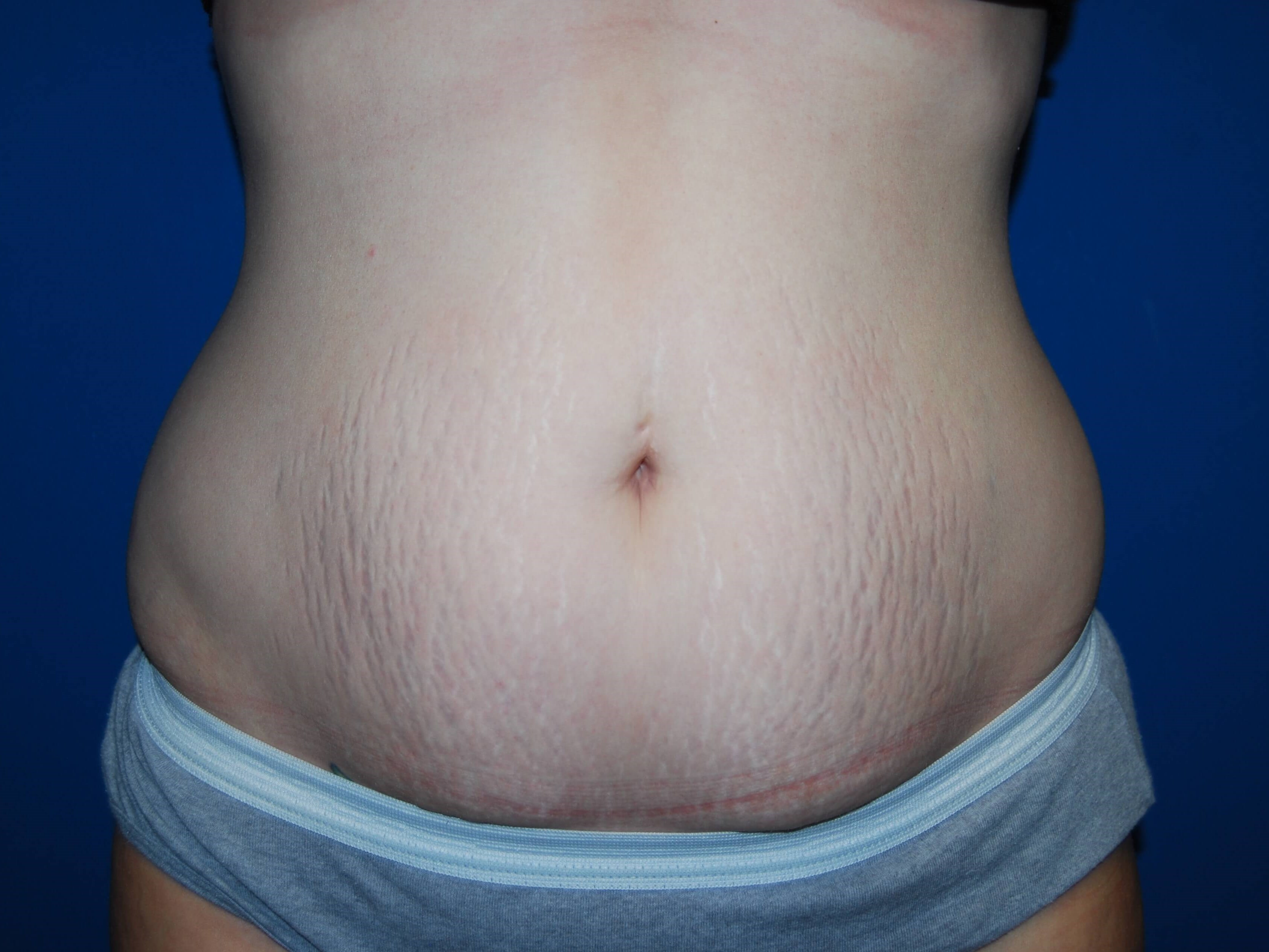 Before Image