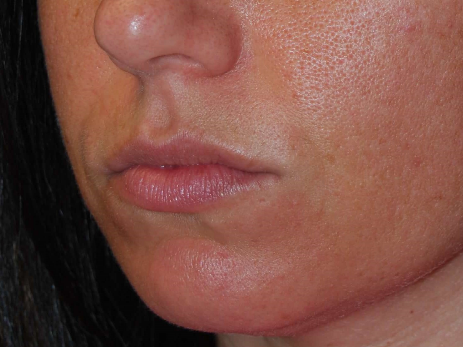 Before Image