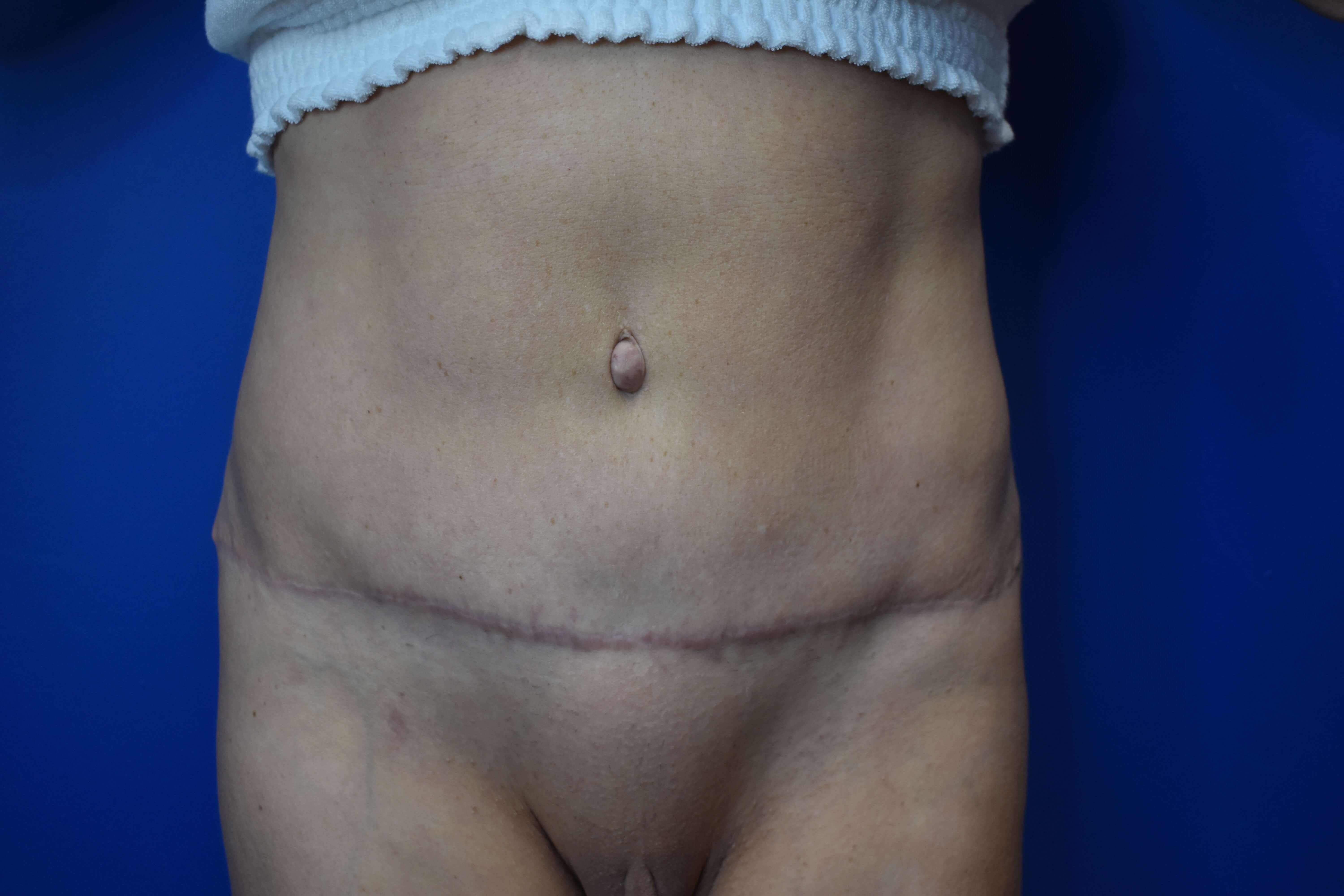 After Image