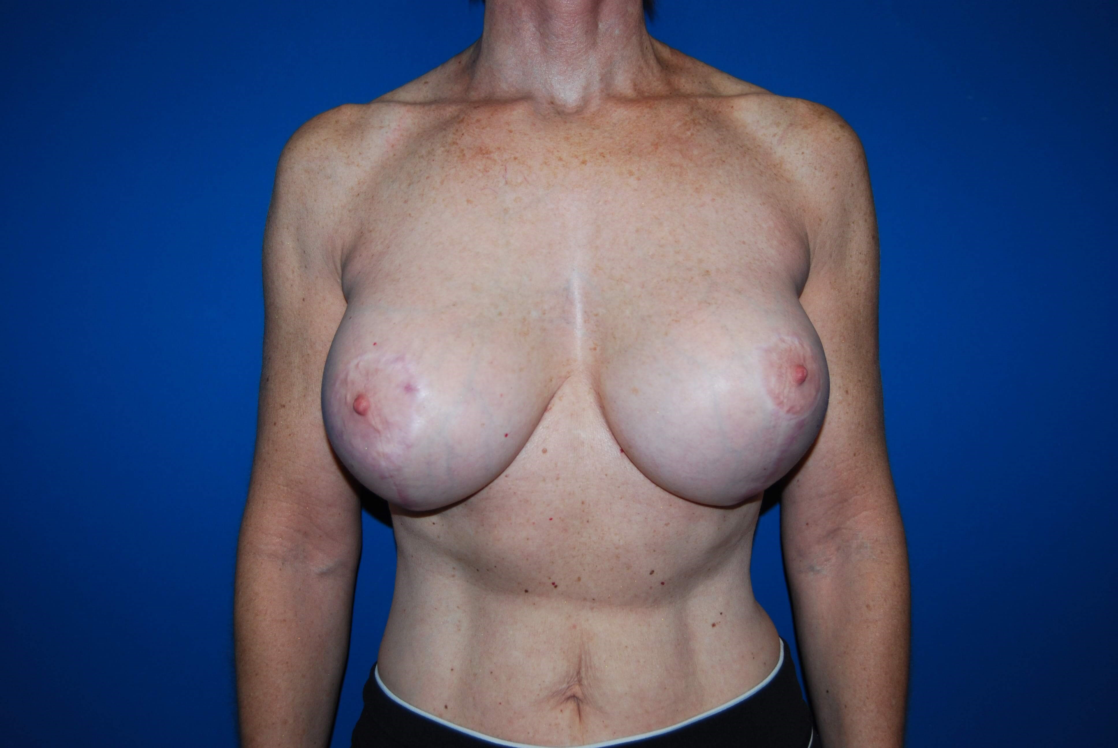 After Image