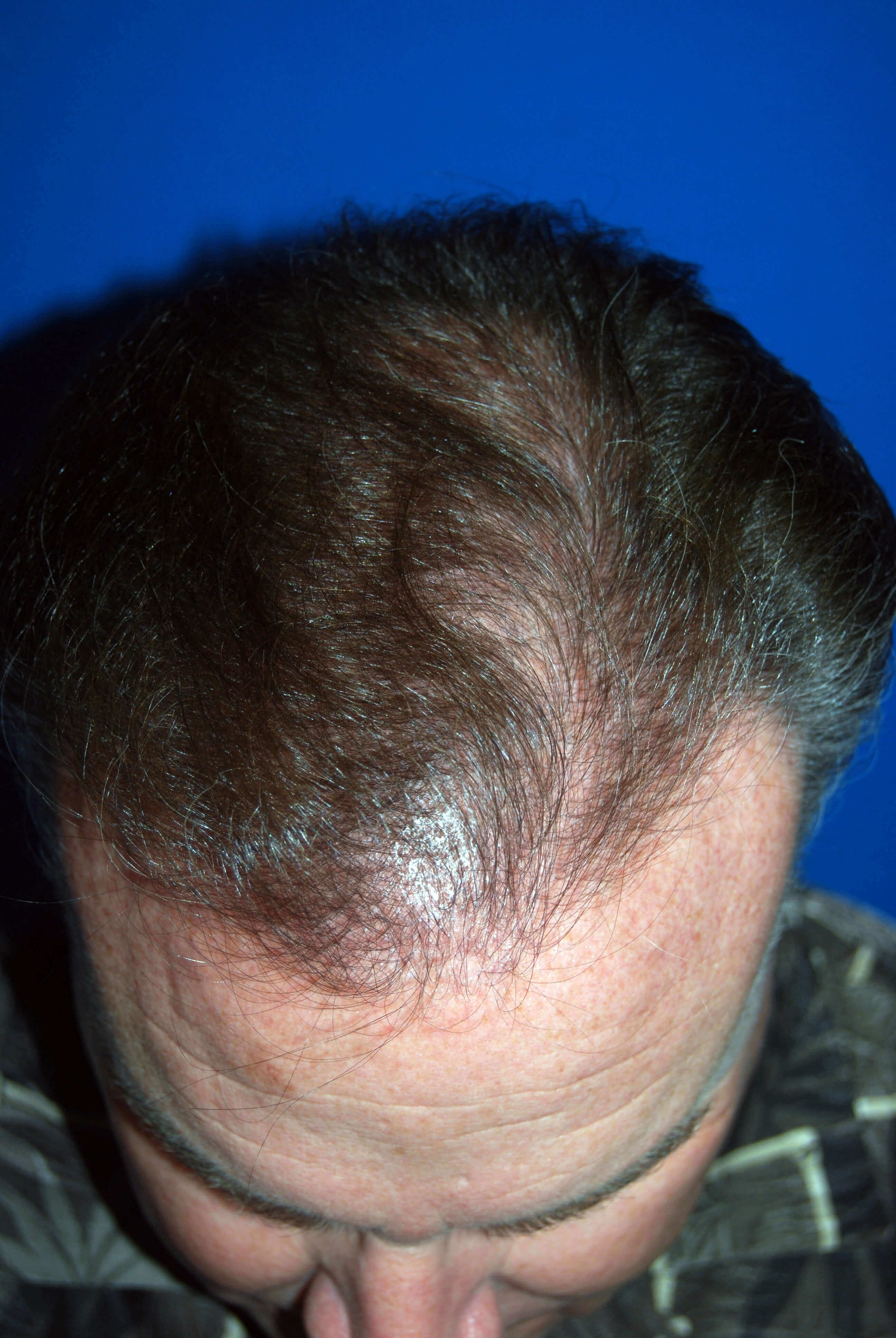 After Image
