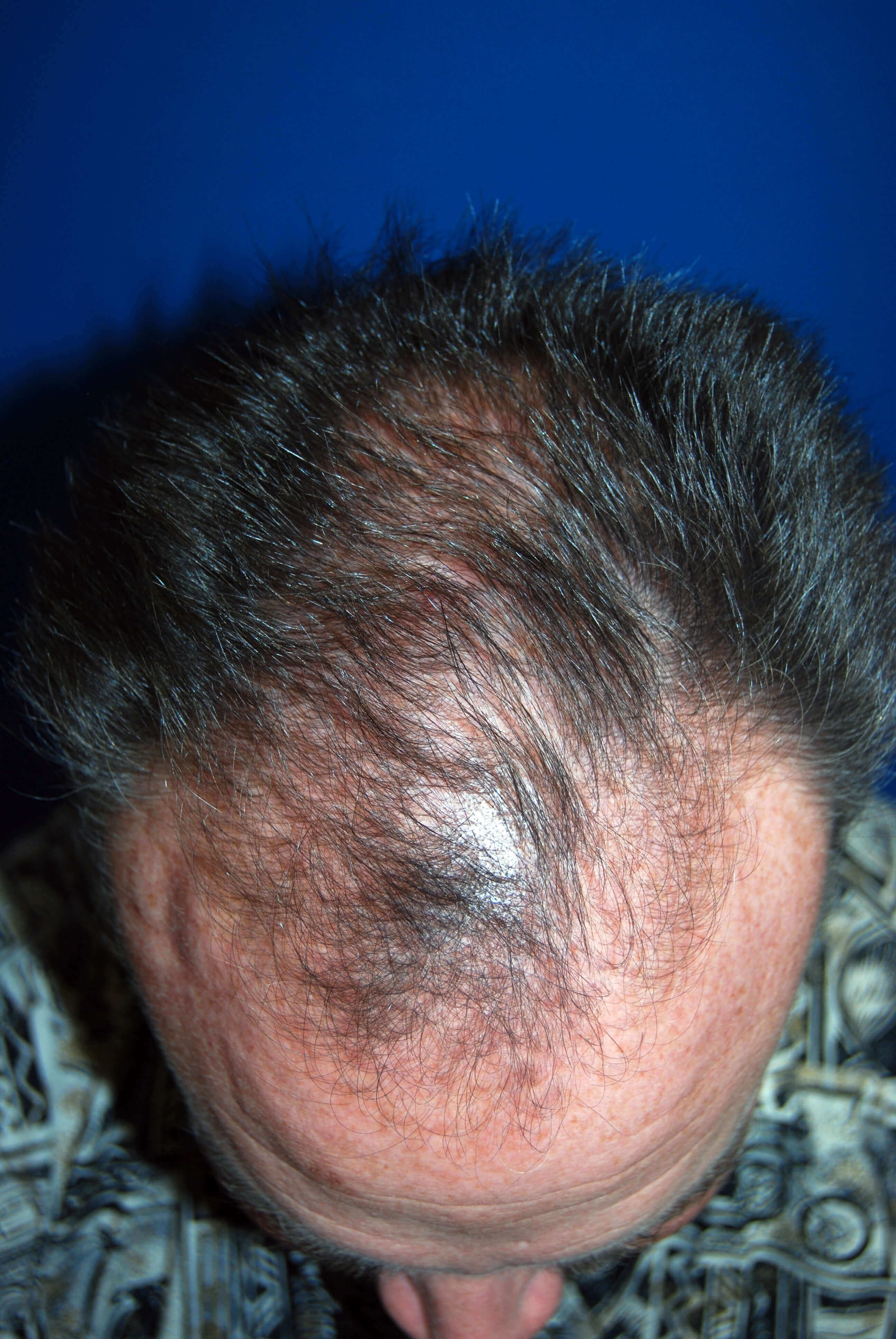 Before Image