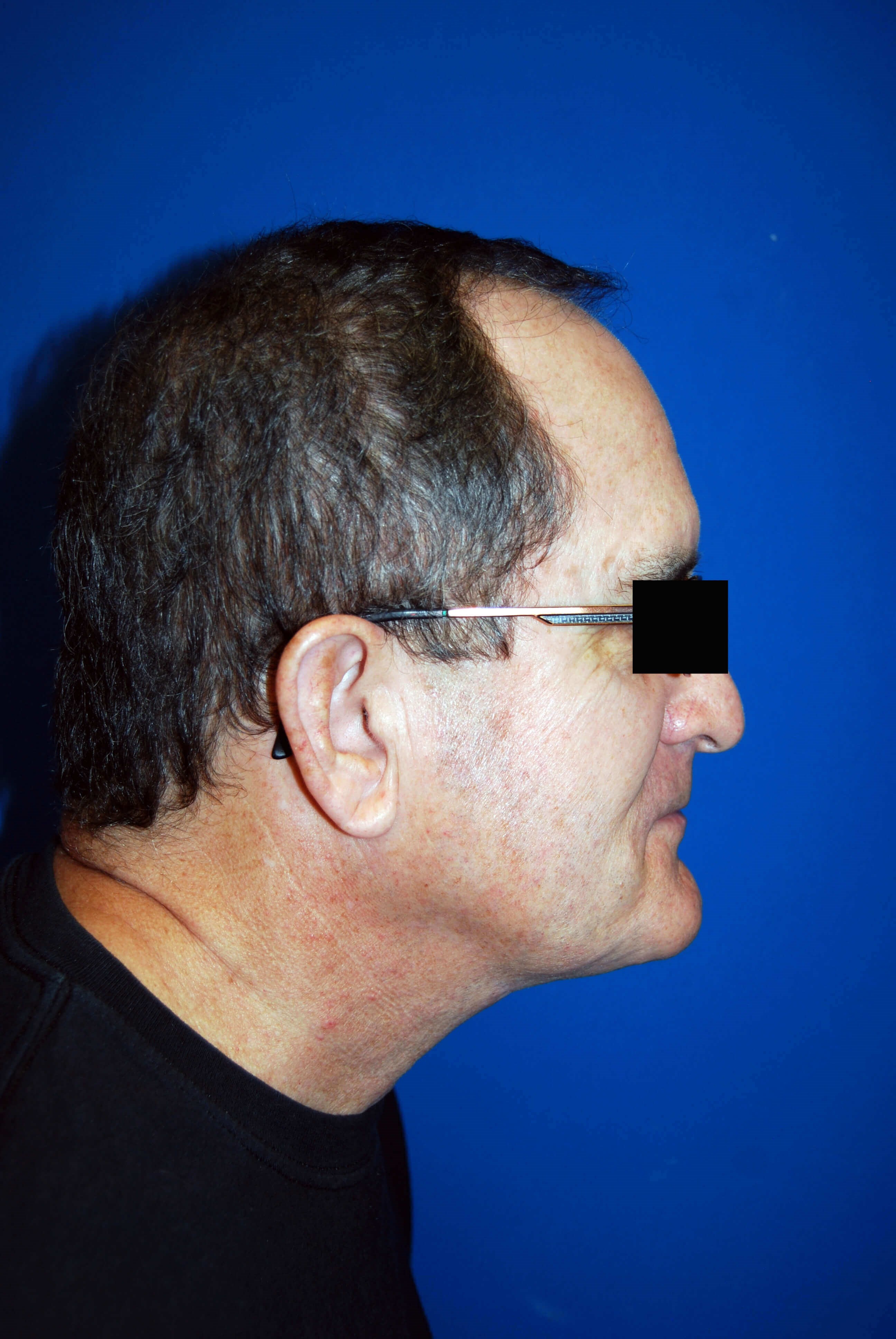 After Image