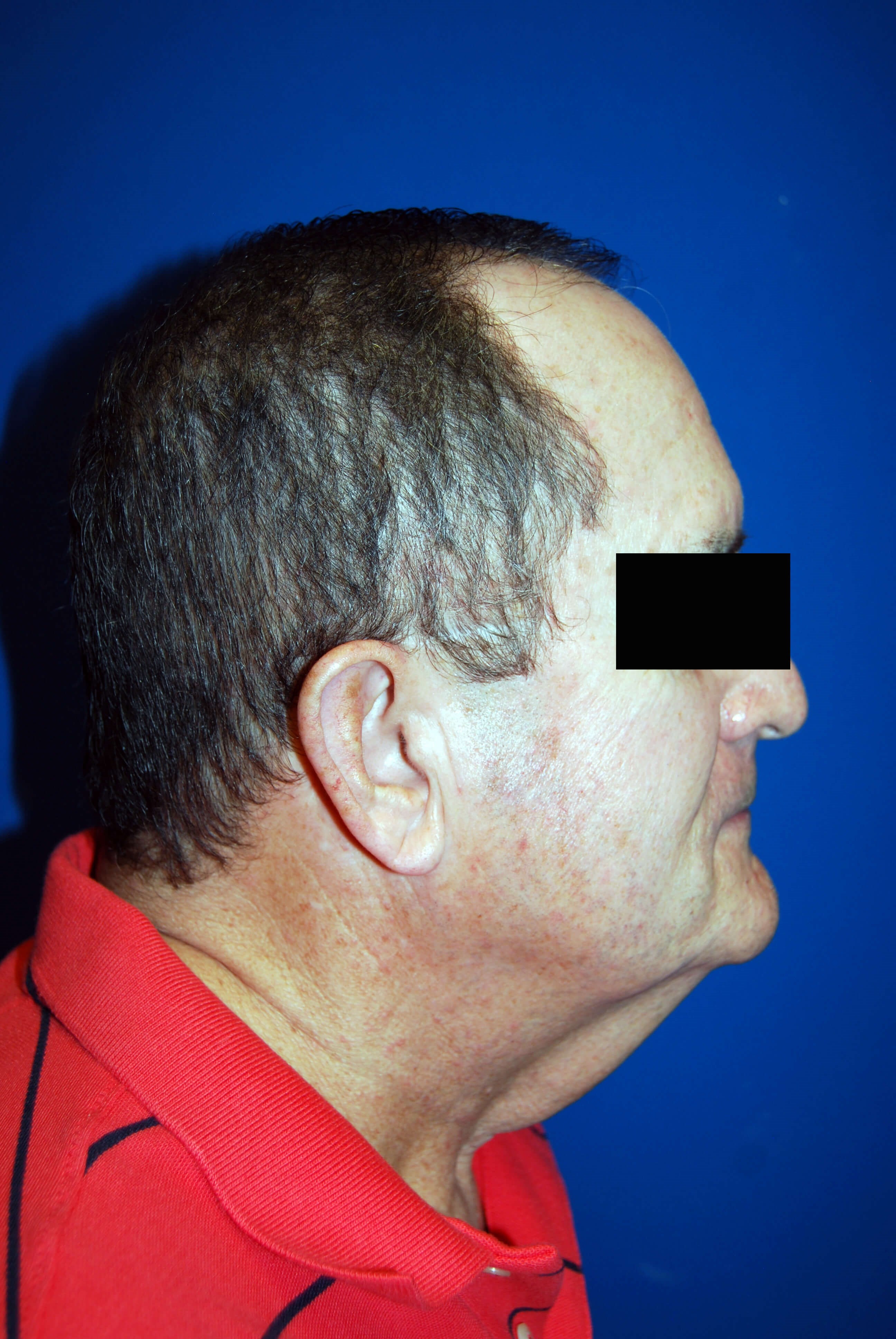 Before Image