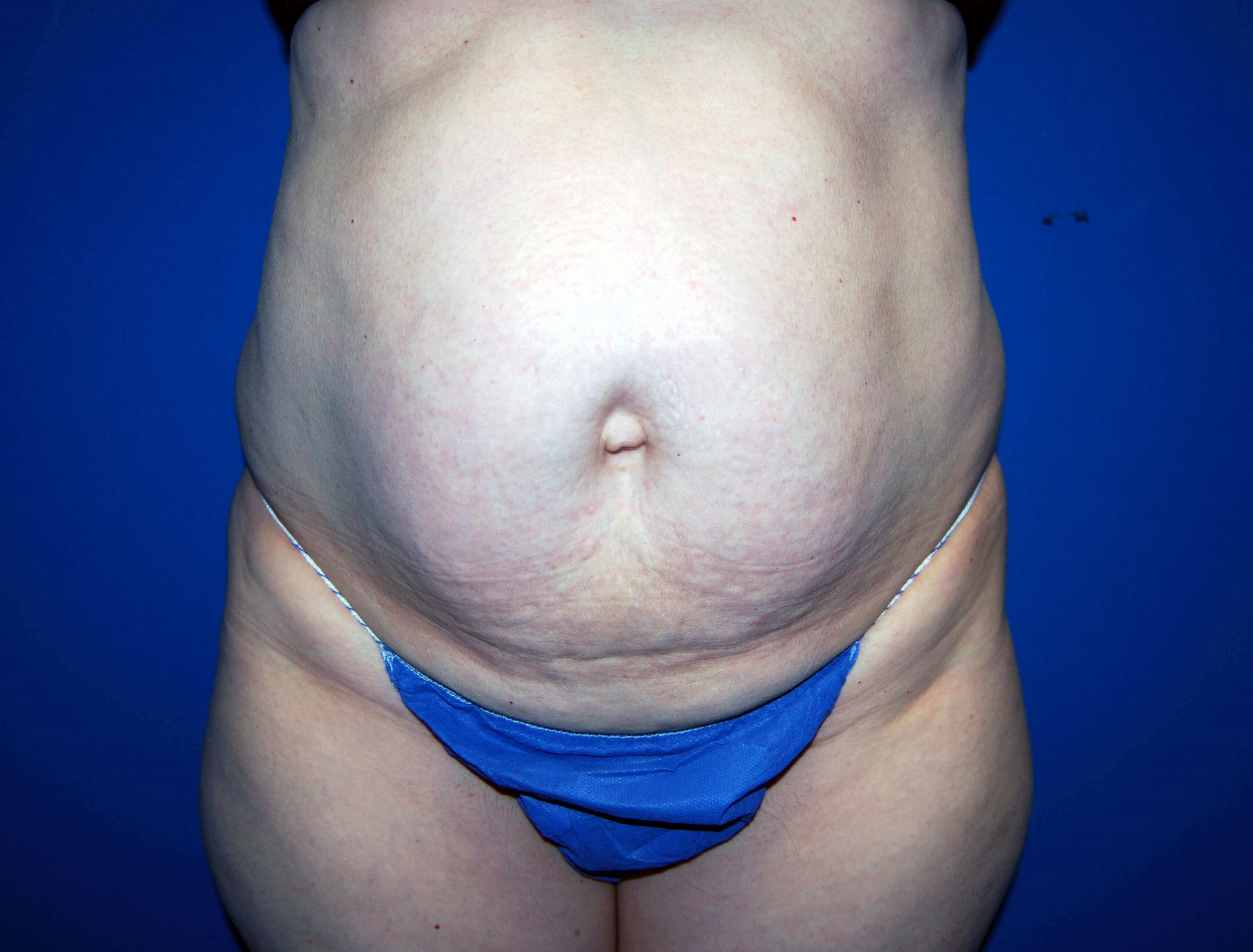 Before Image