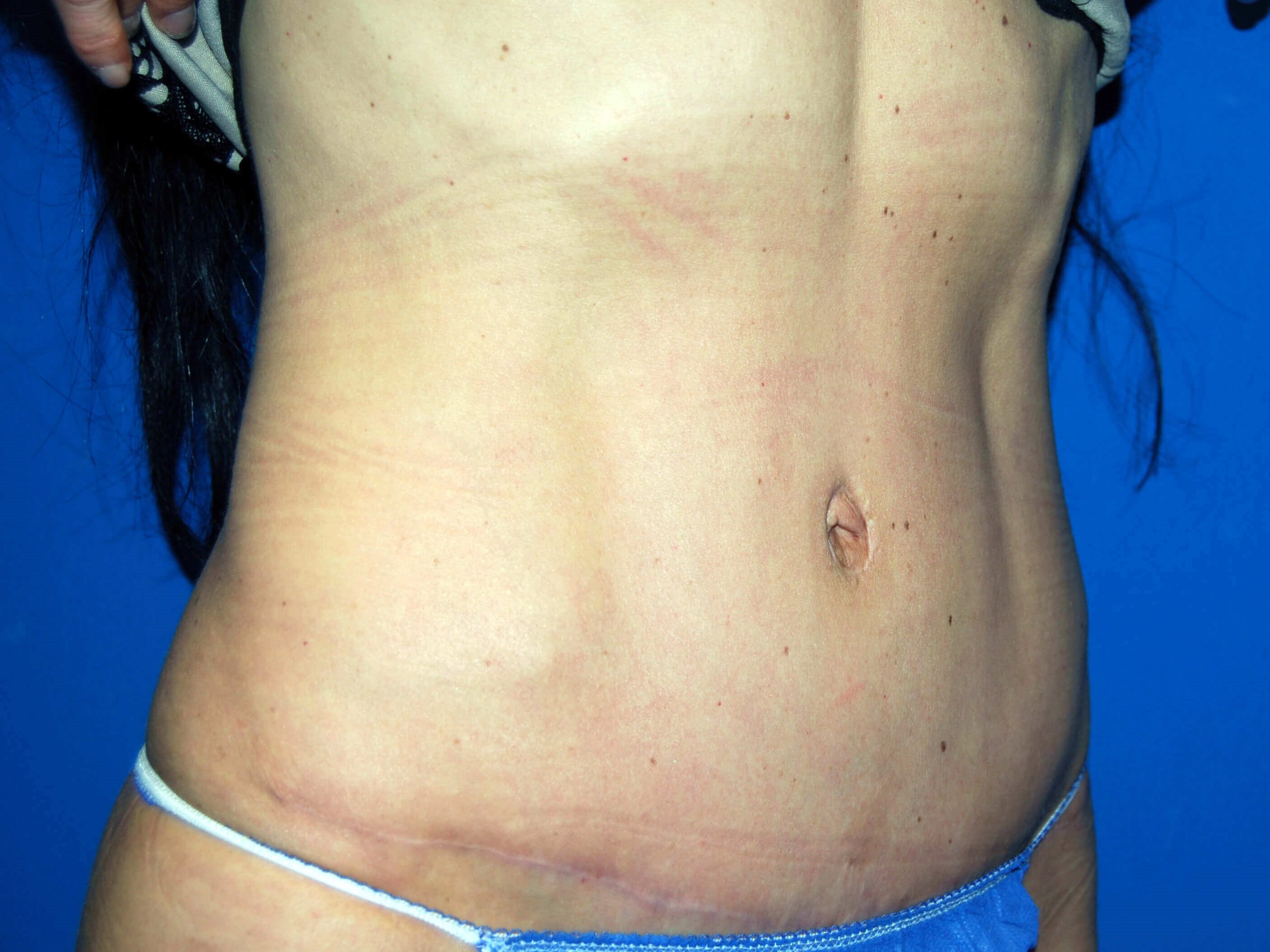 Right After