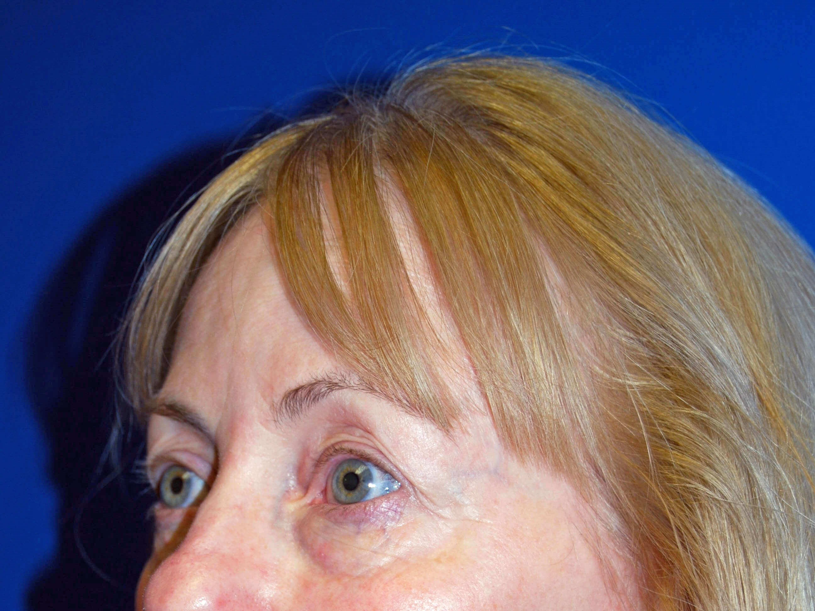 Left Before