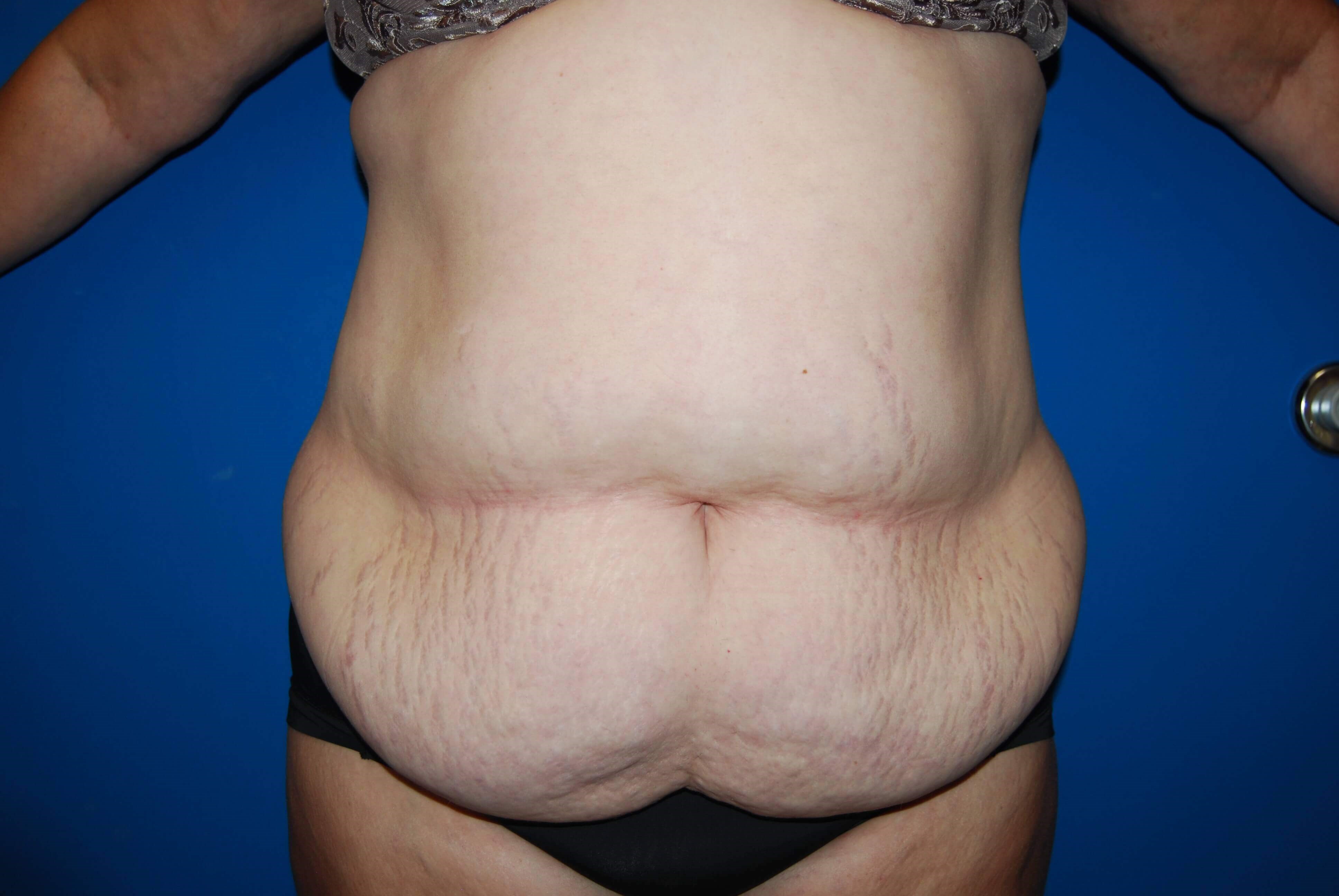 Before Image