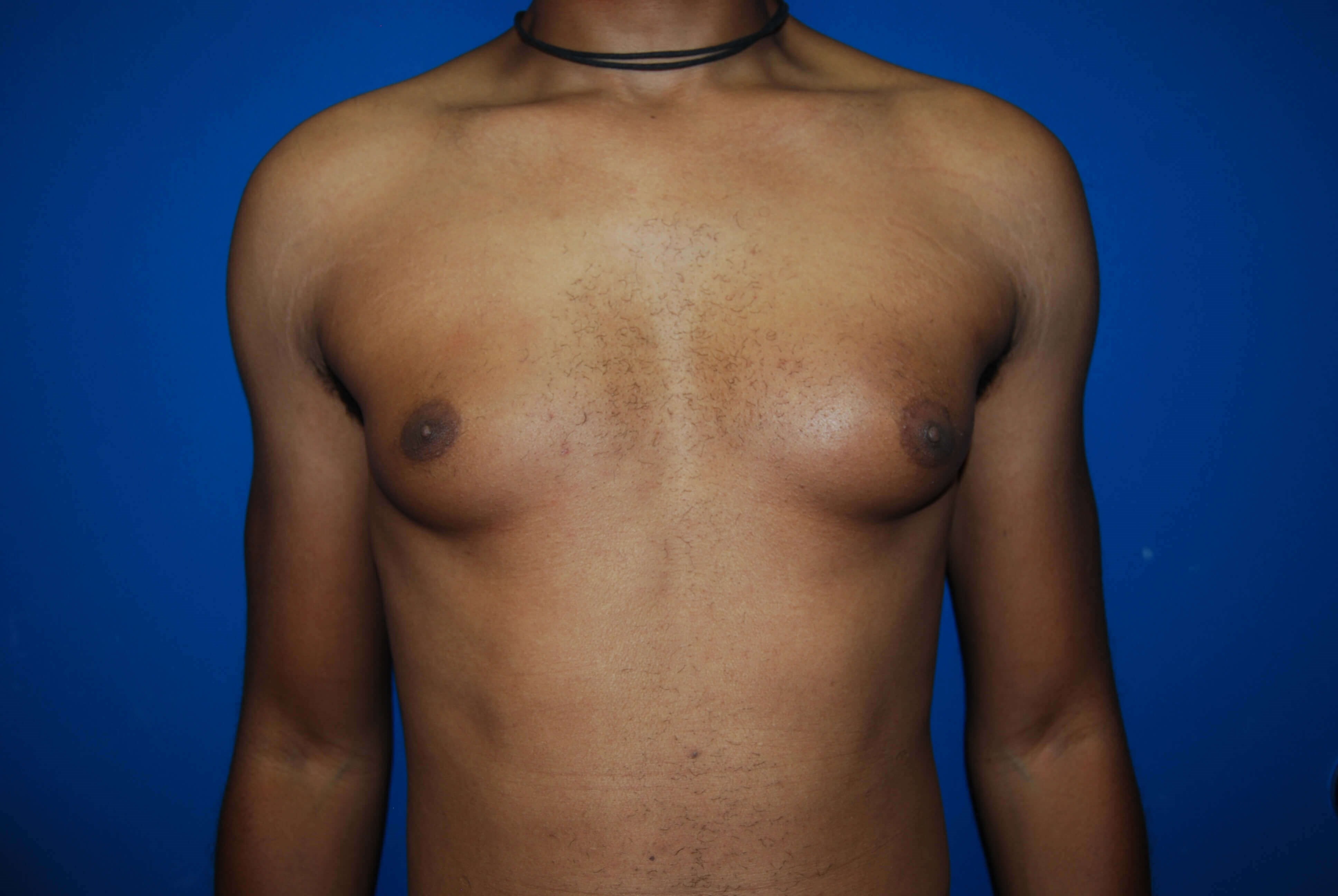 Before Image