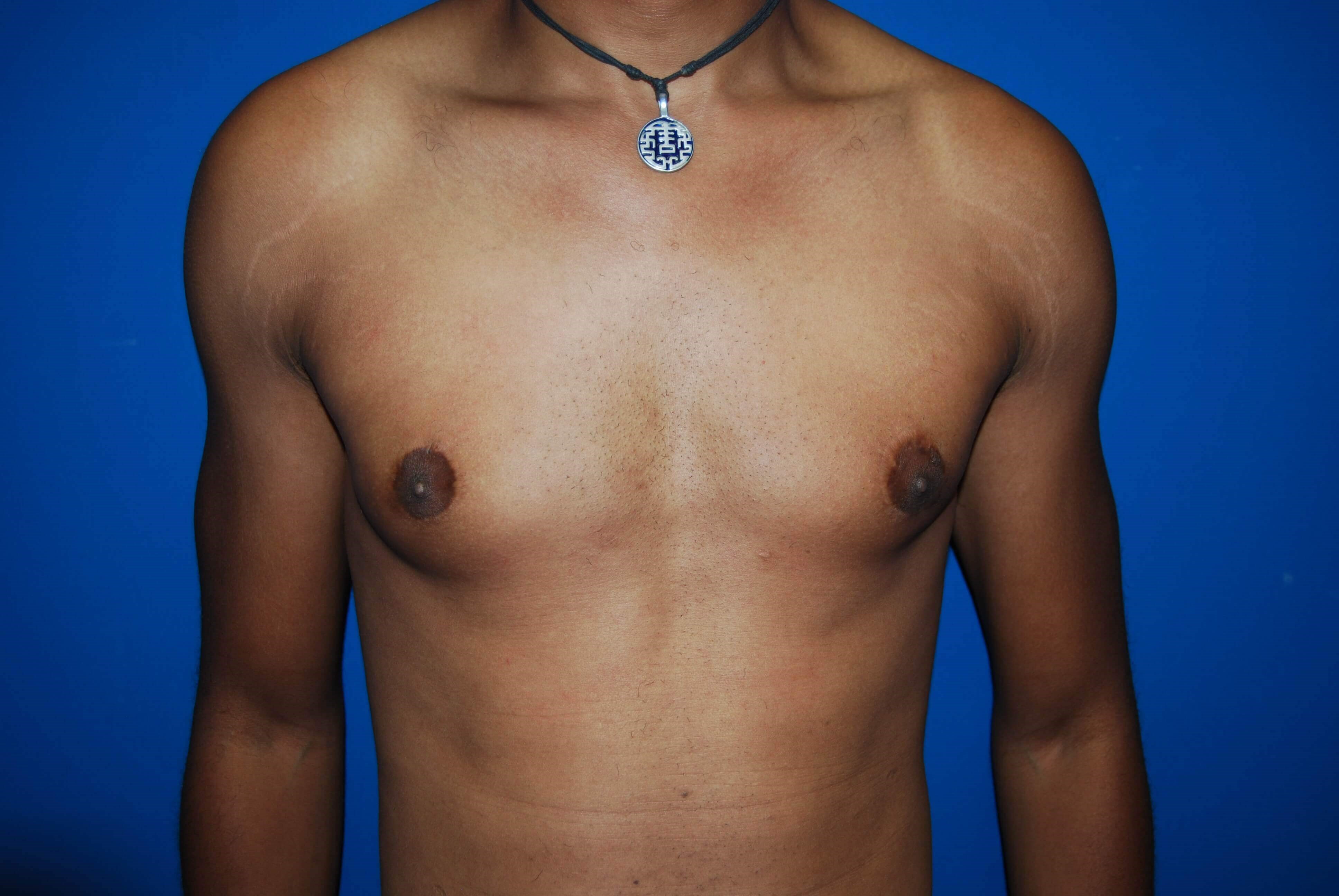 After Image