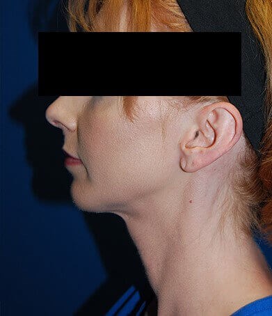 After Image