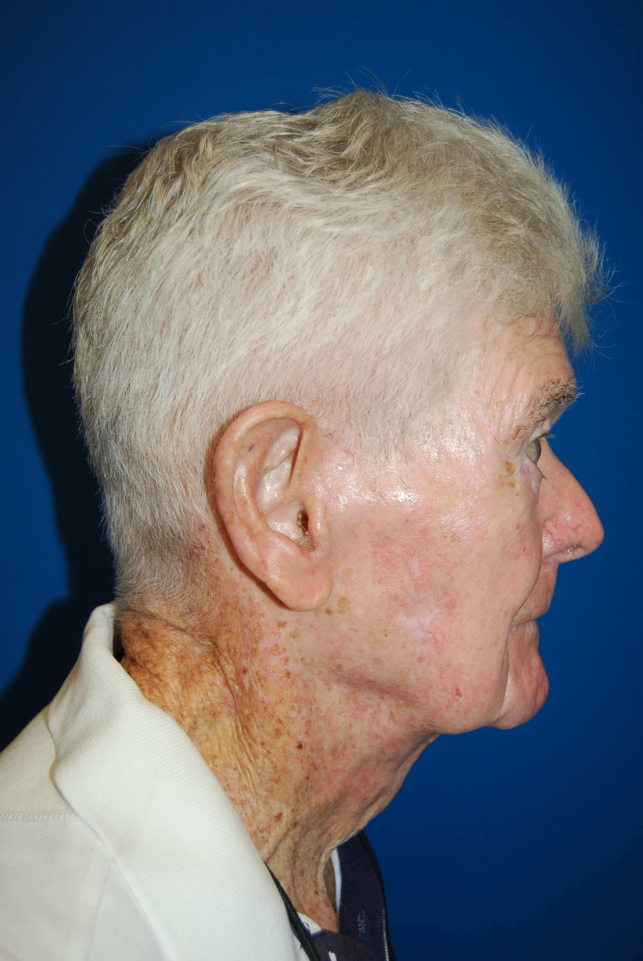 After Image