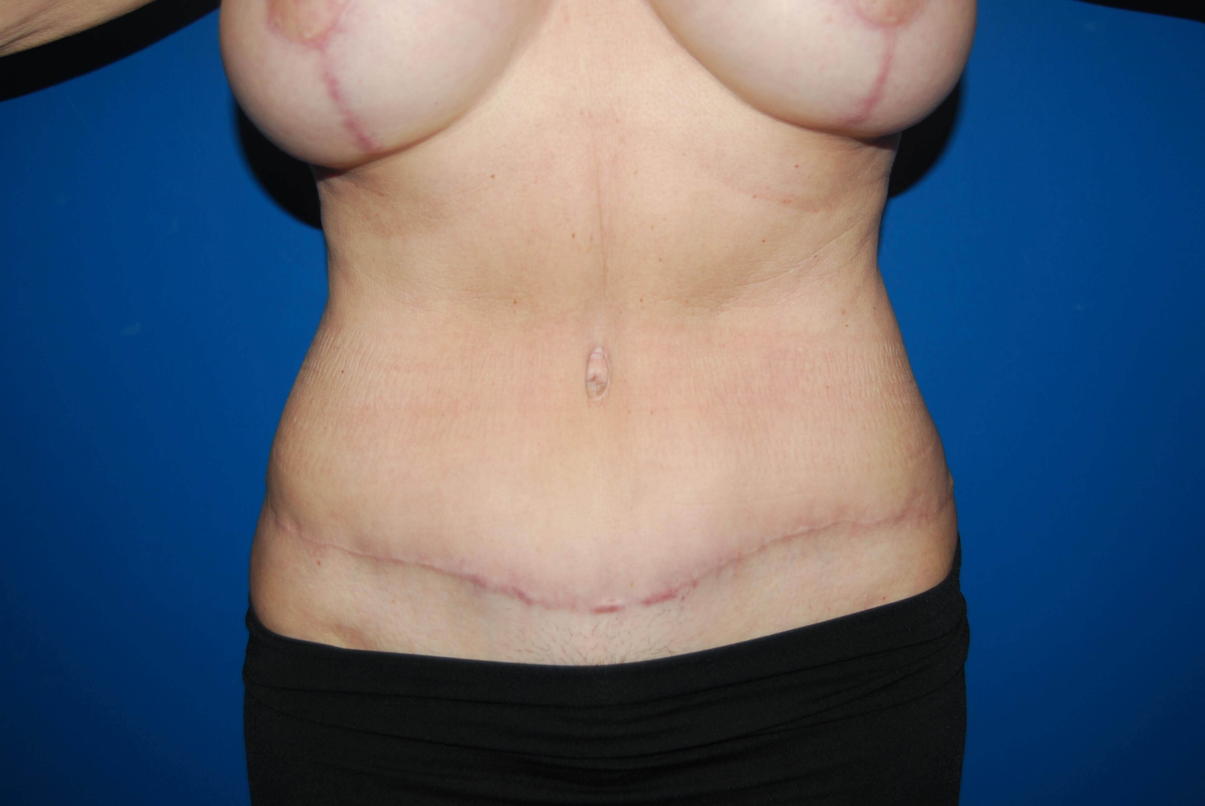 After Image