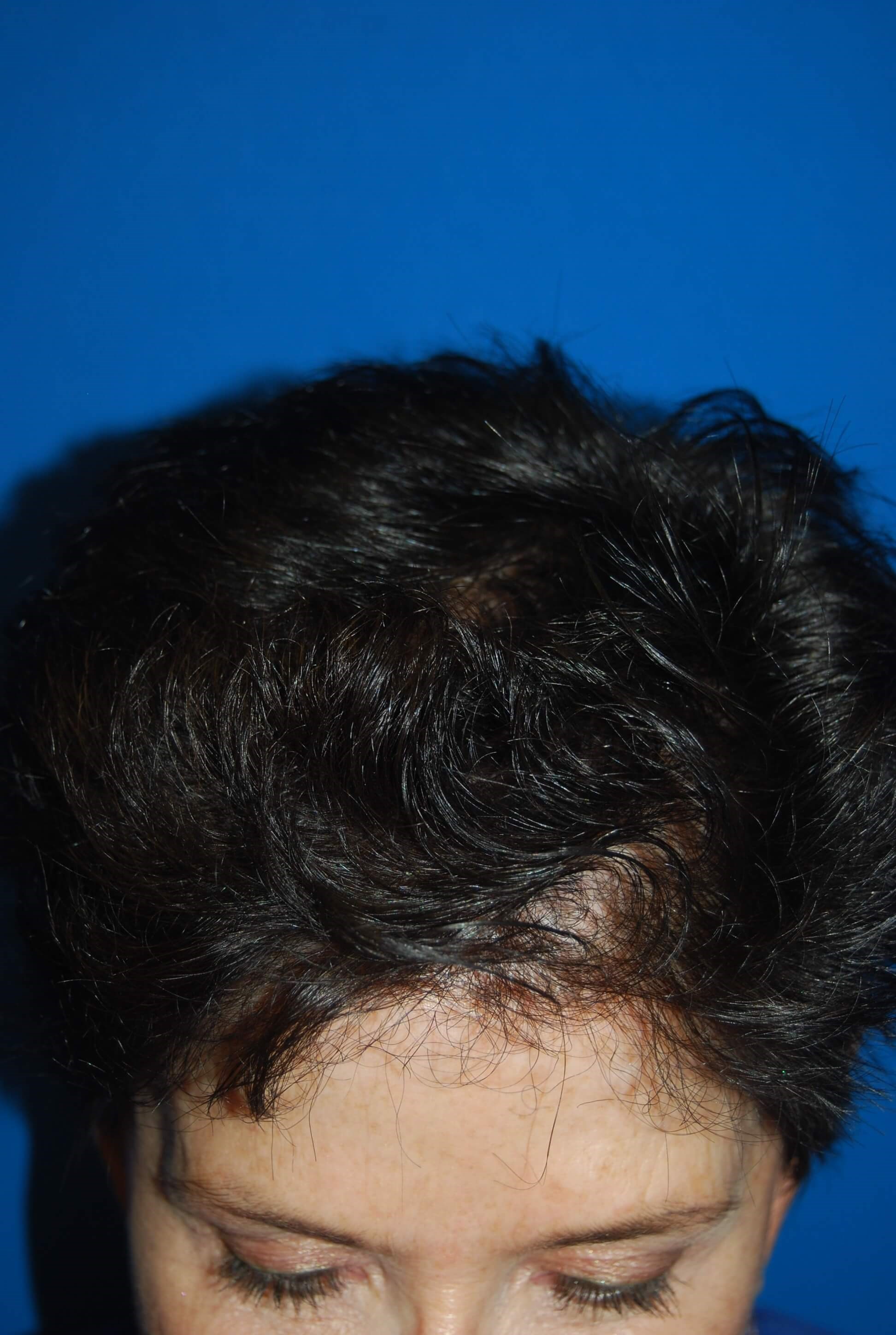After Image
