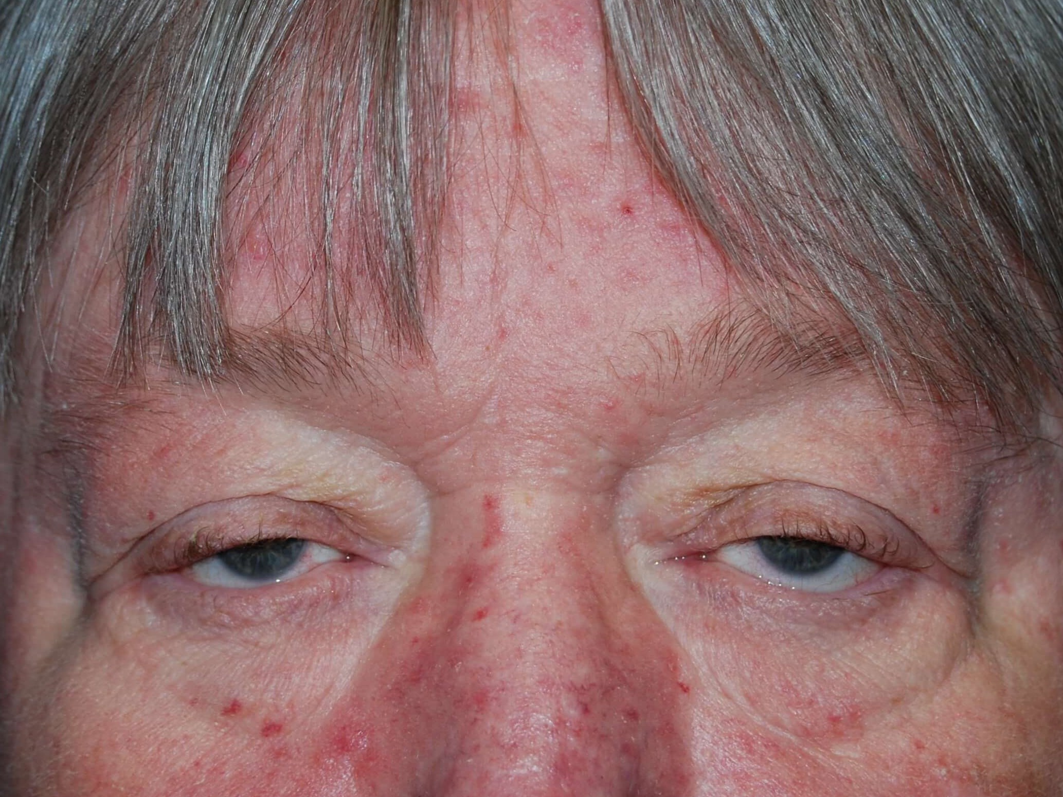 Front View Before