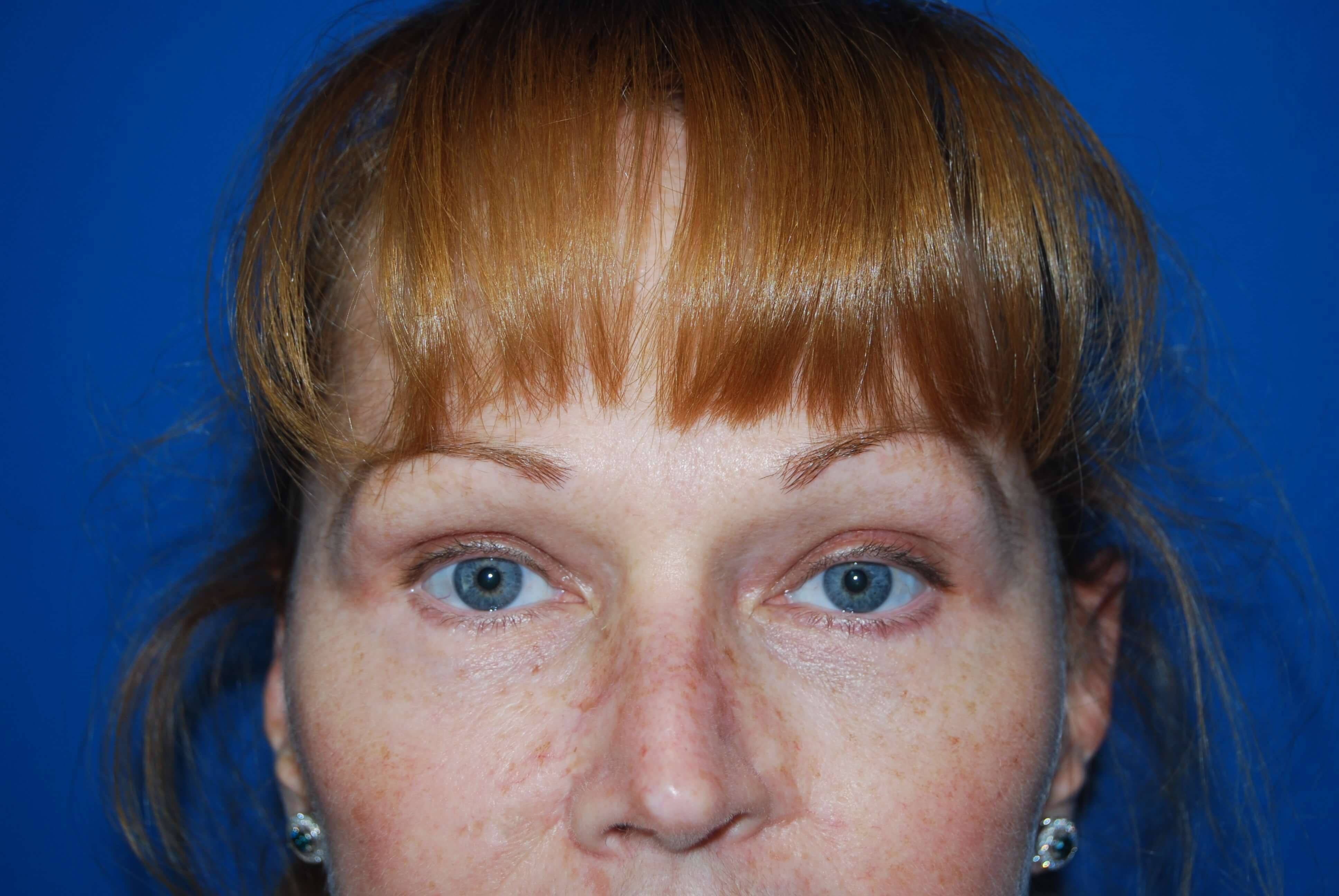 After Image
