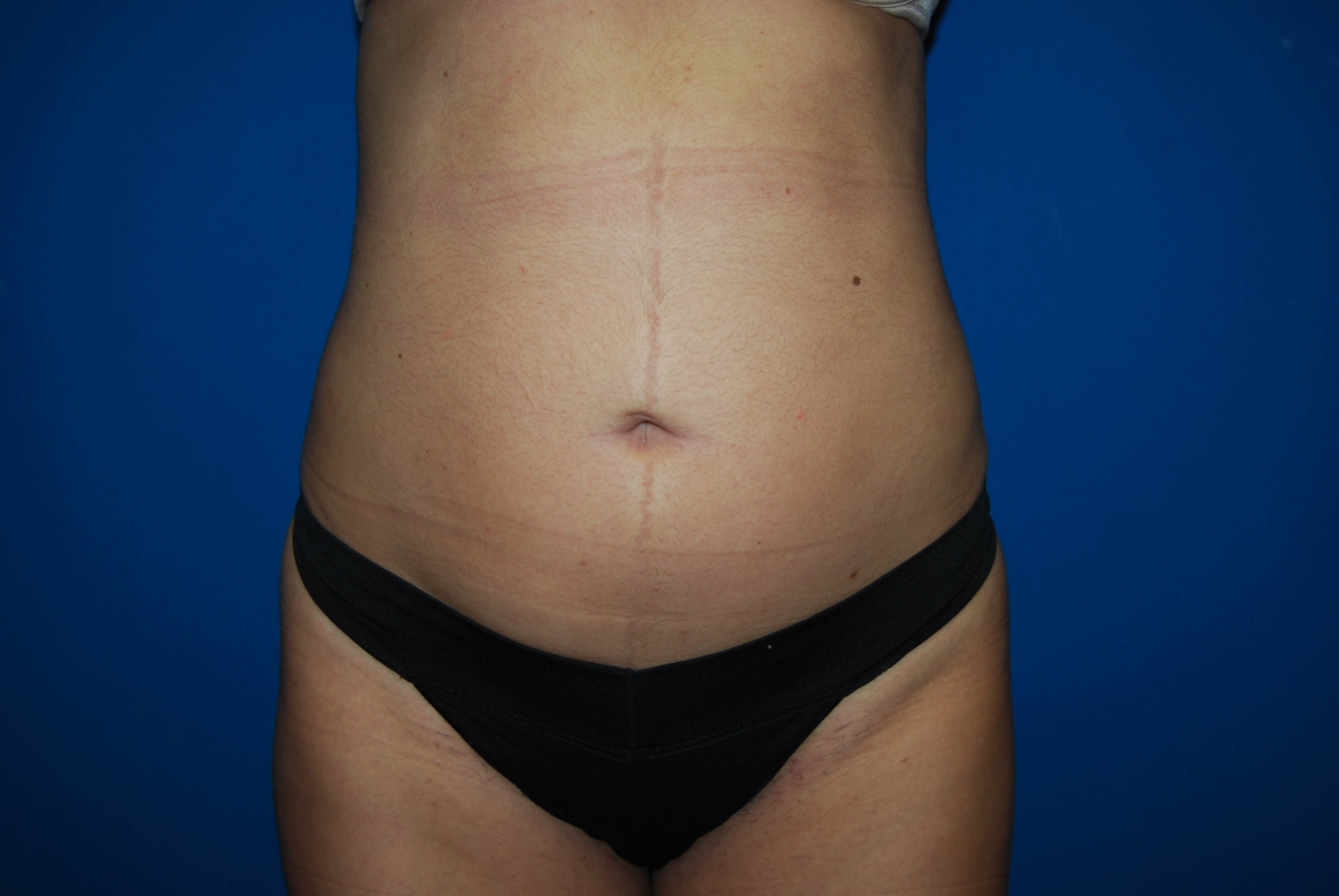 After Image