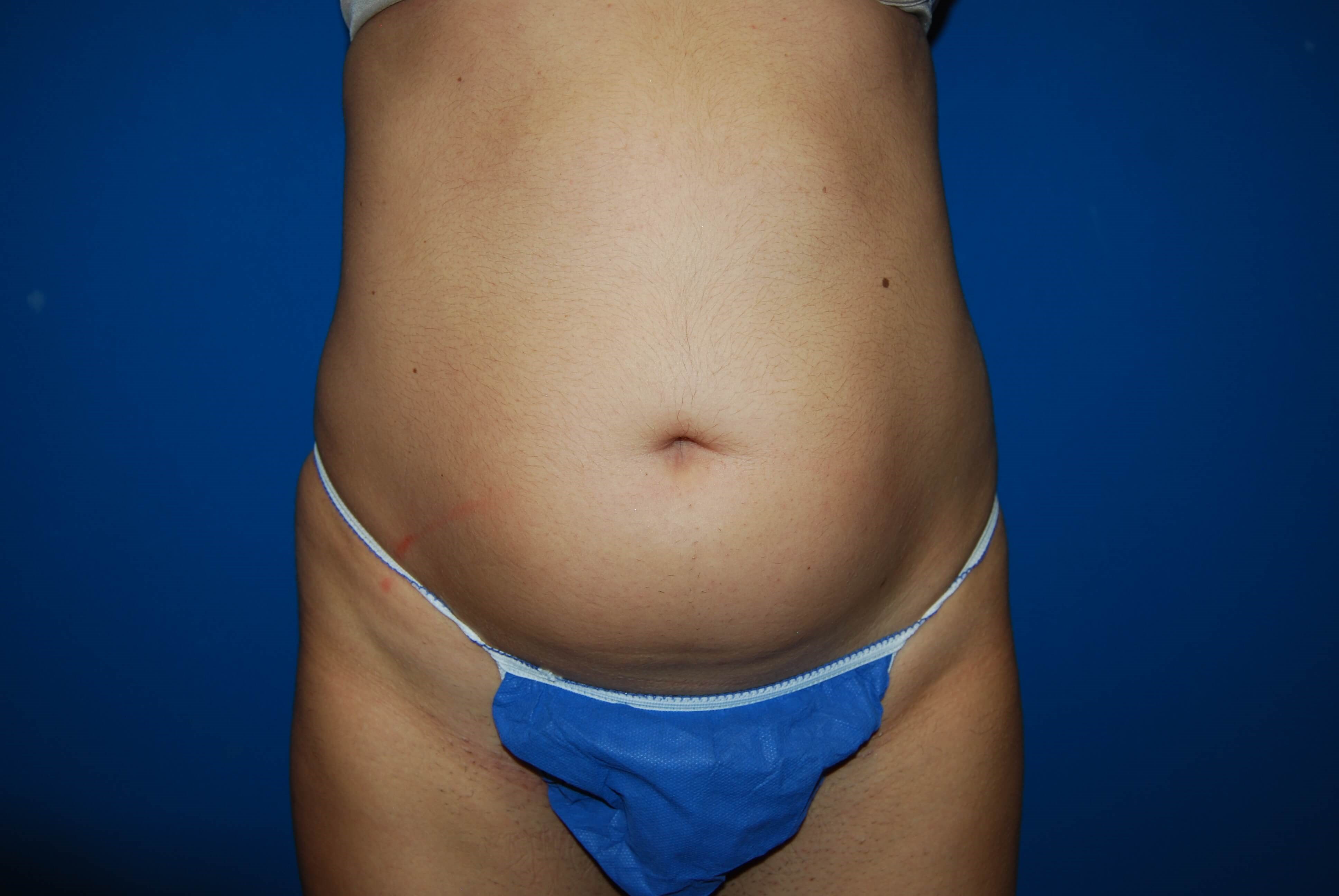 Before Image