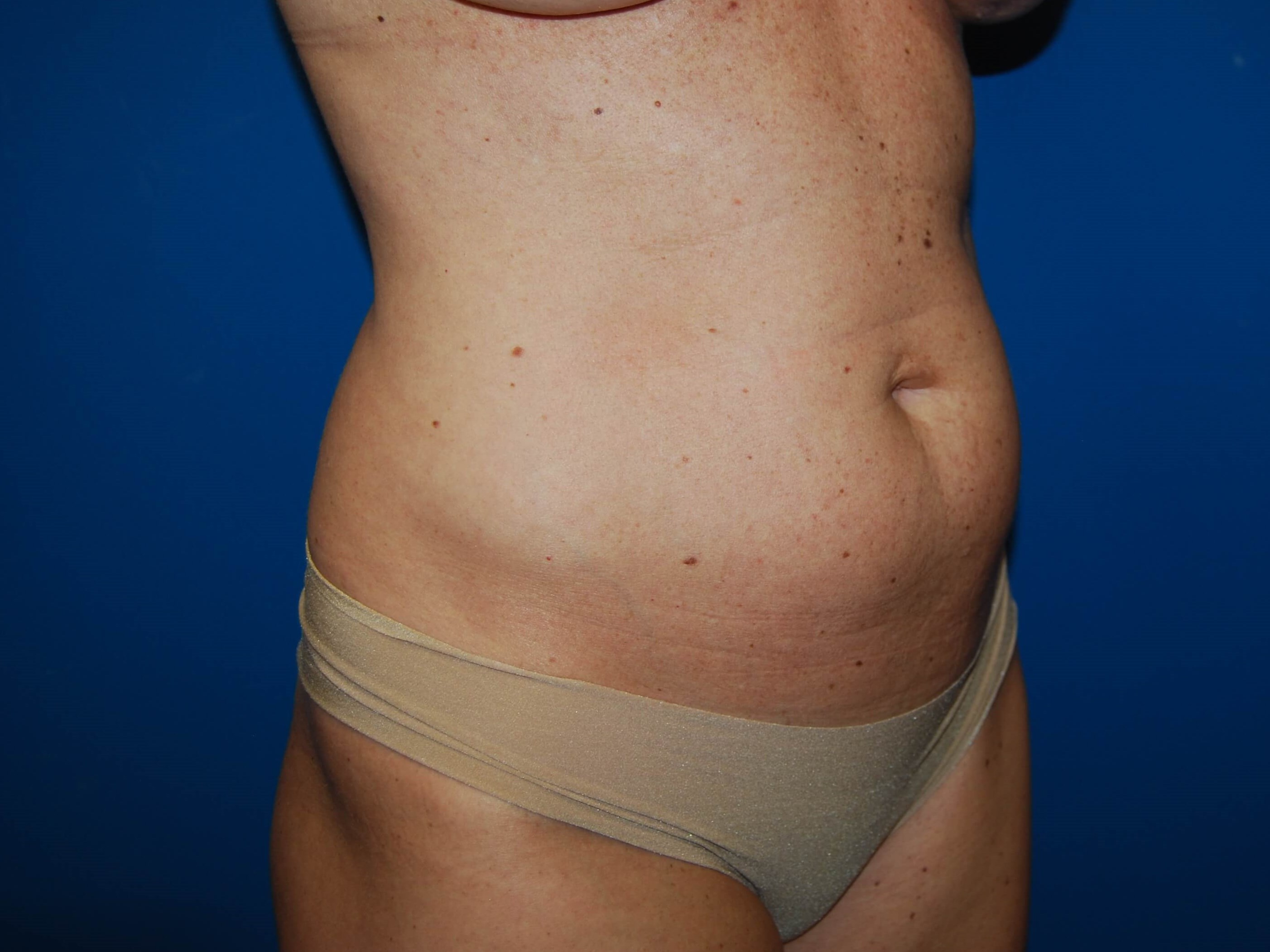 Oblique - Right Before