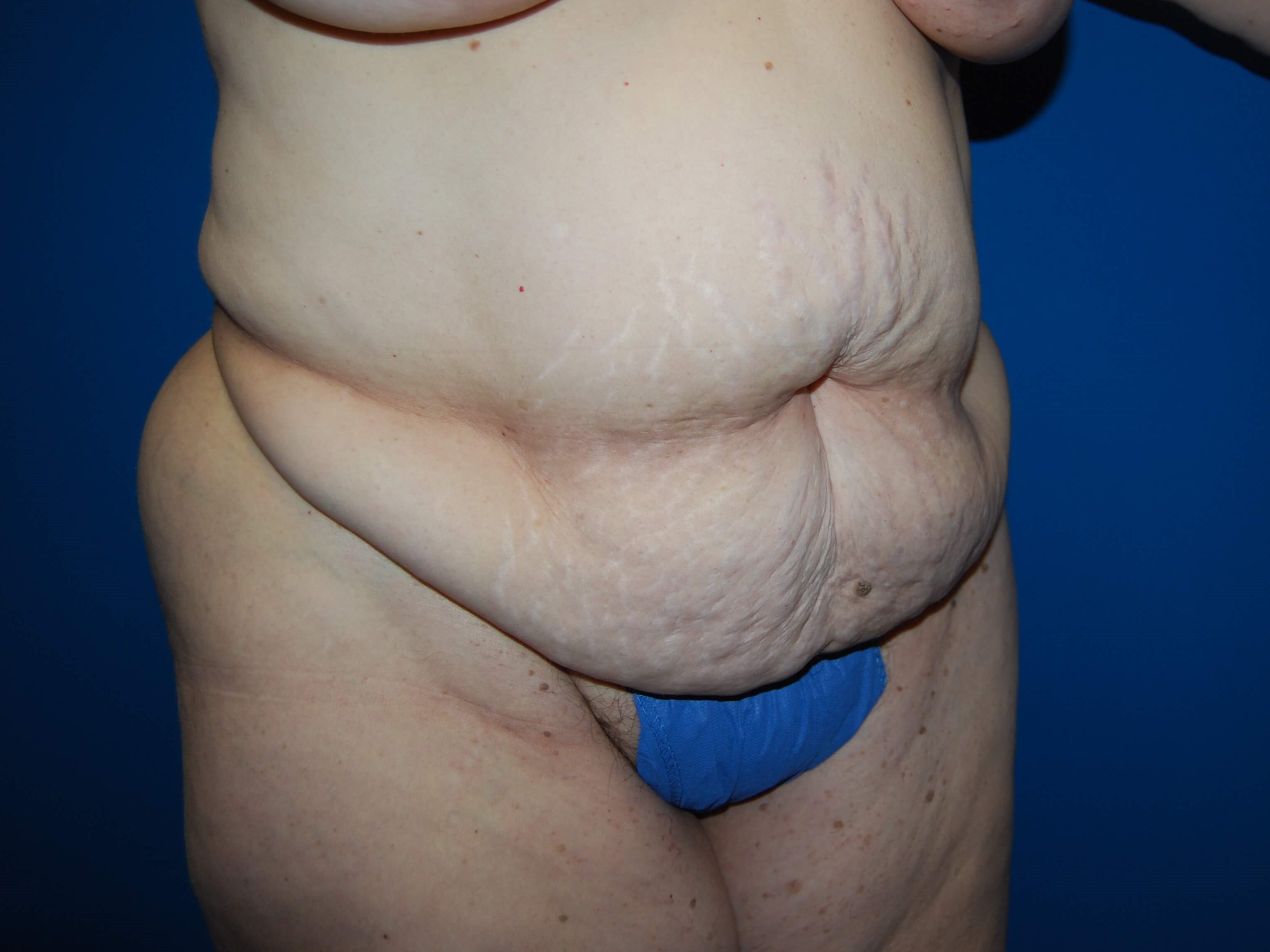 Oblique - Right Before