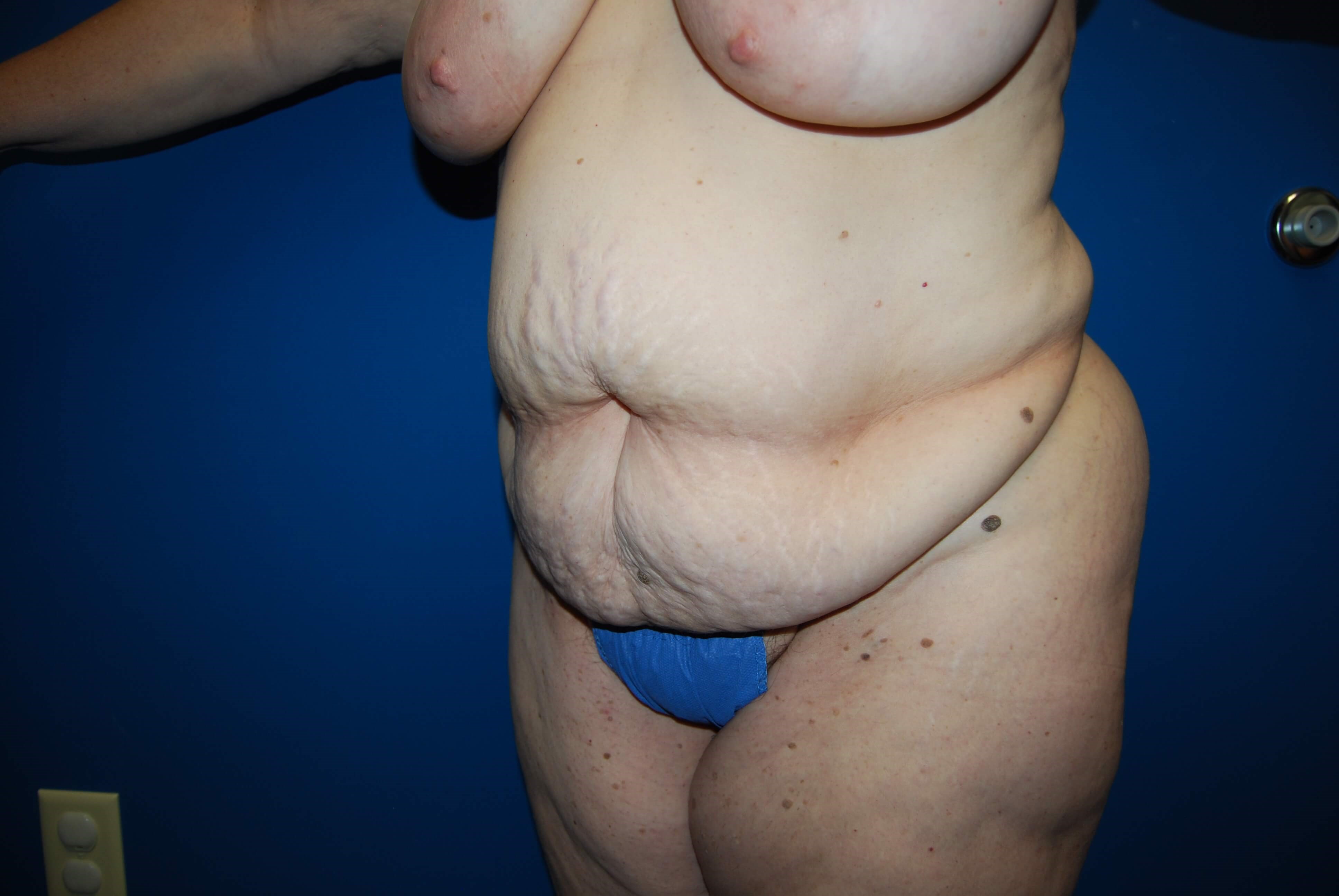 Oblique - Left Before