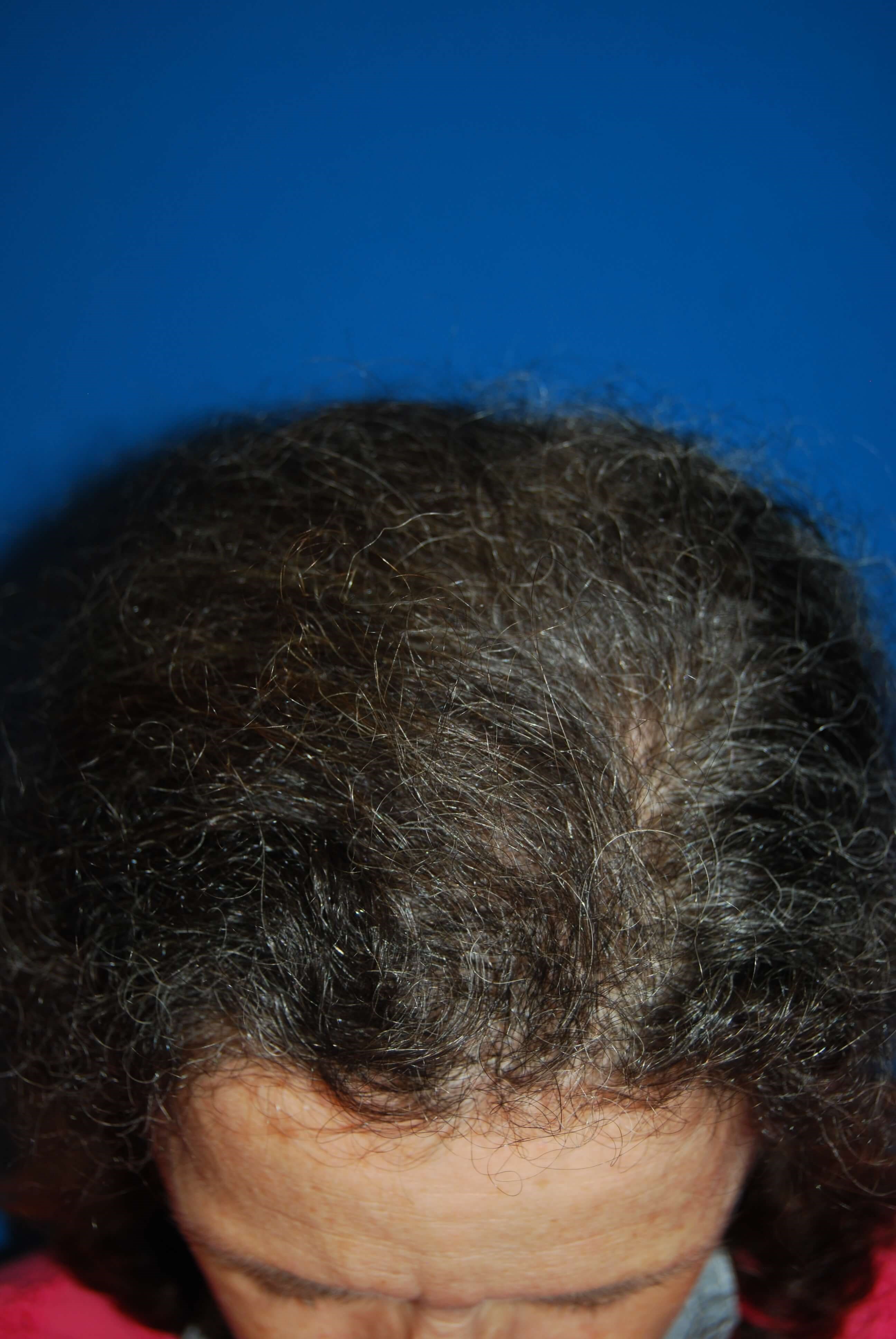 After Image