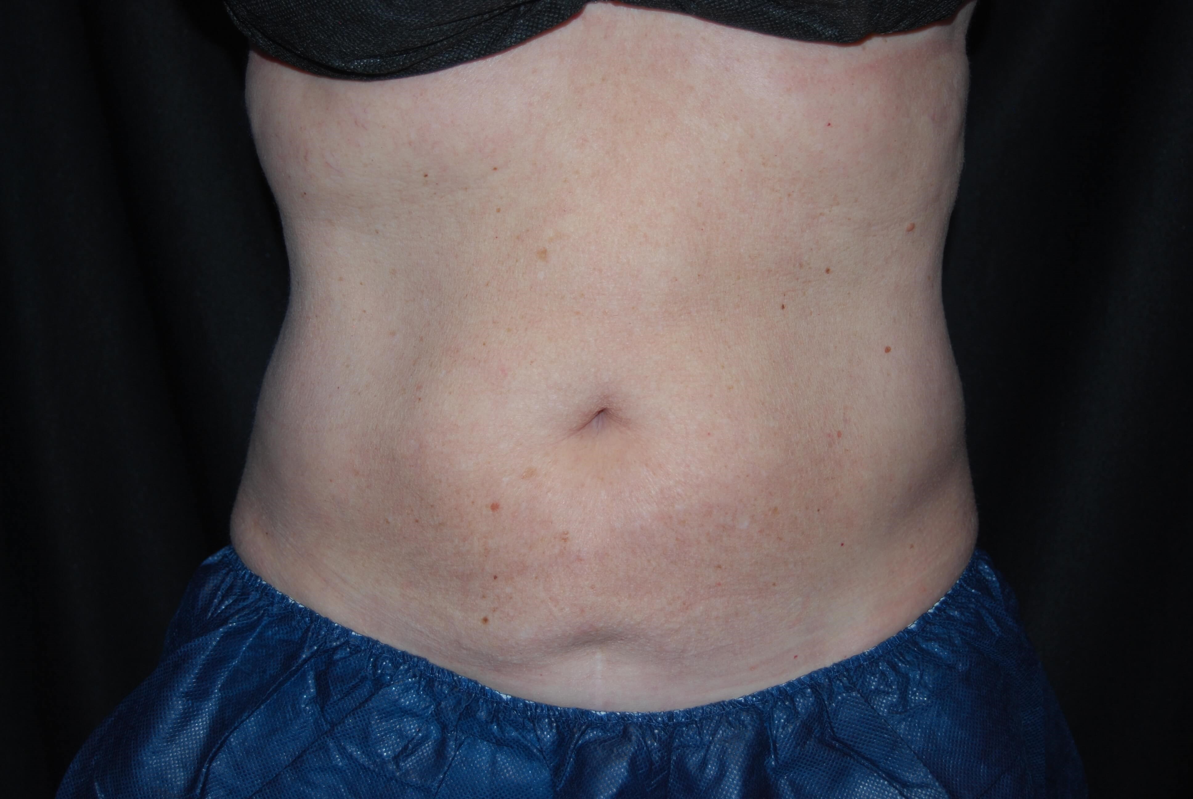 After Image