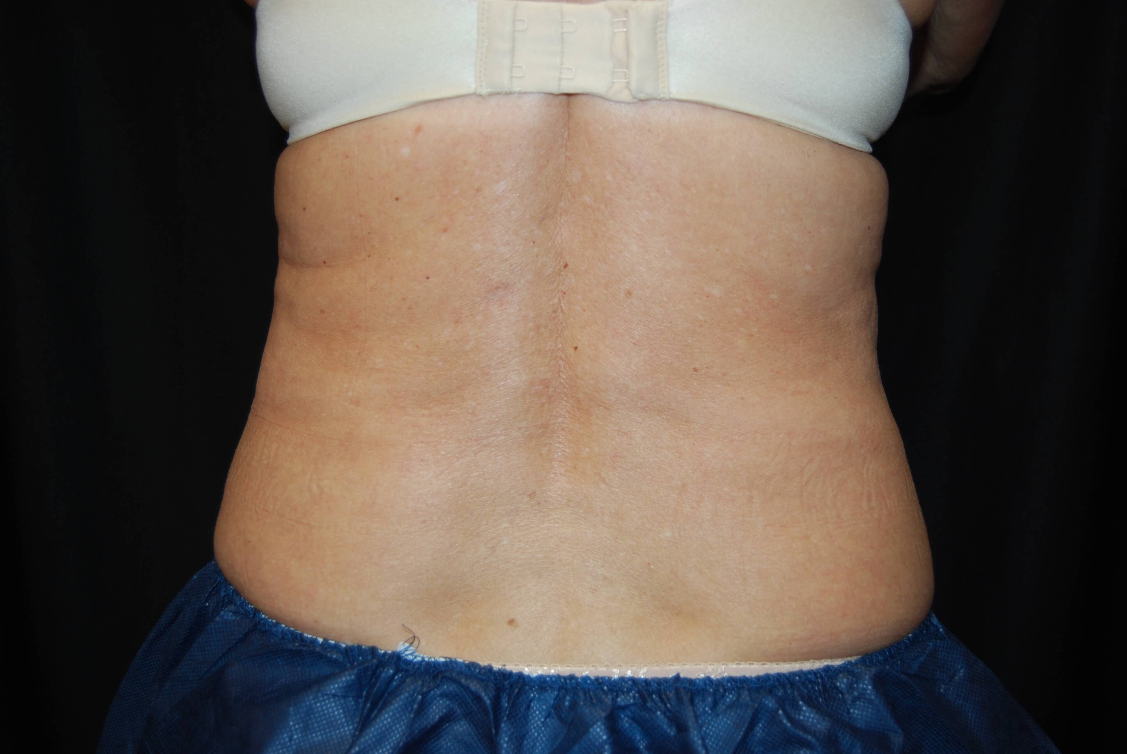 After Image