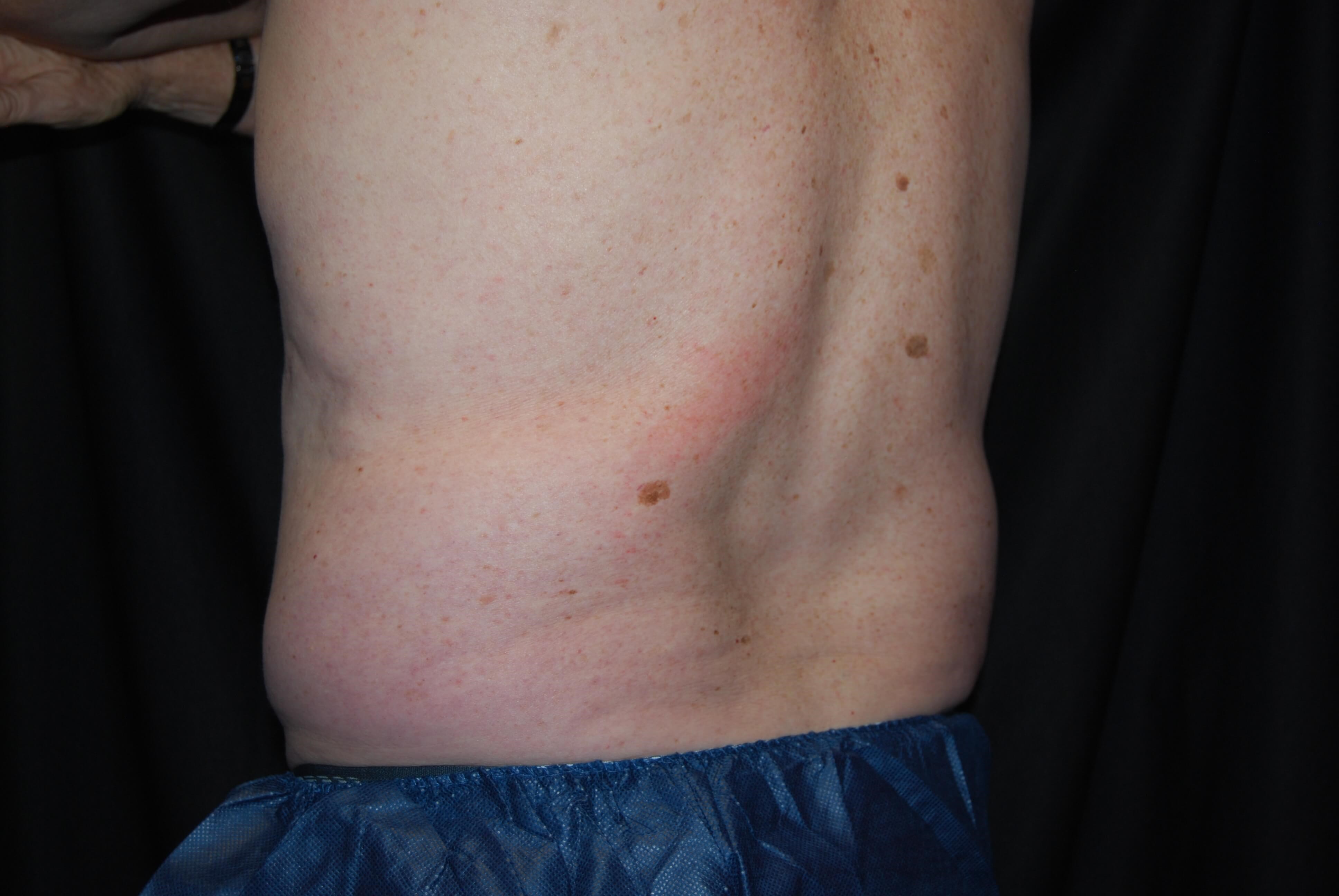 After Image