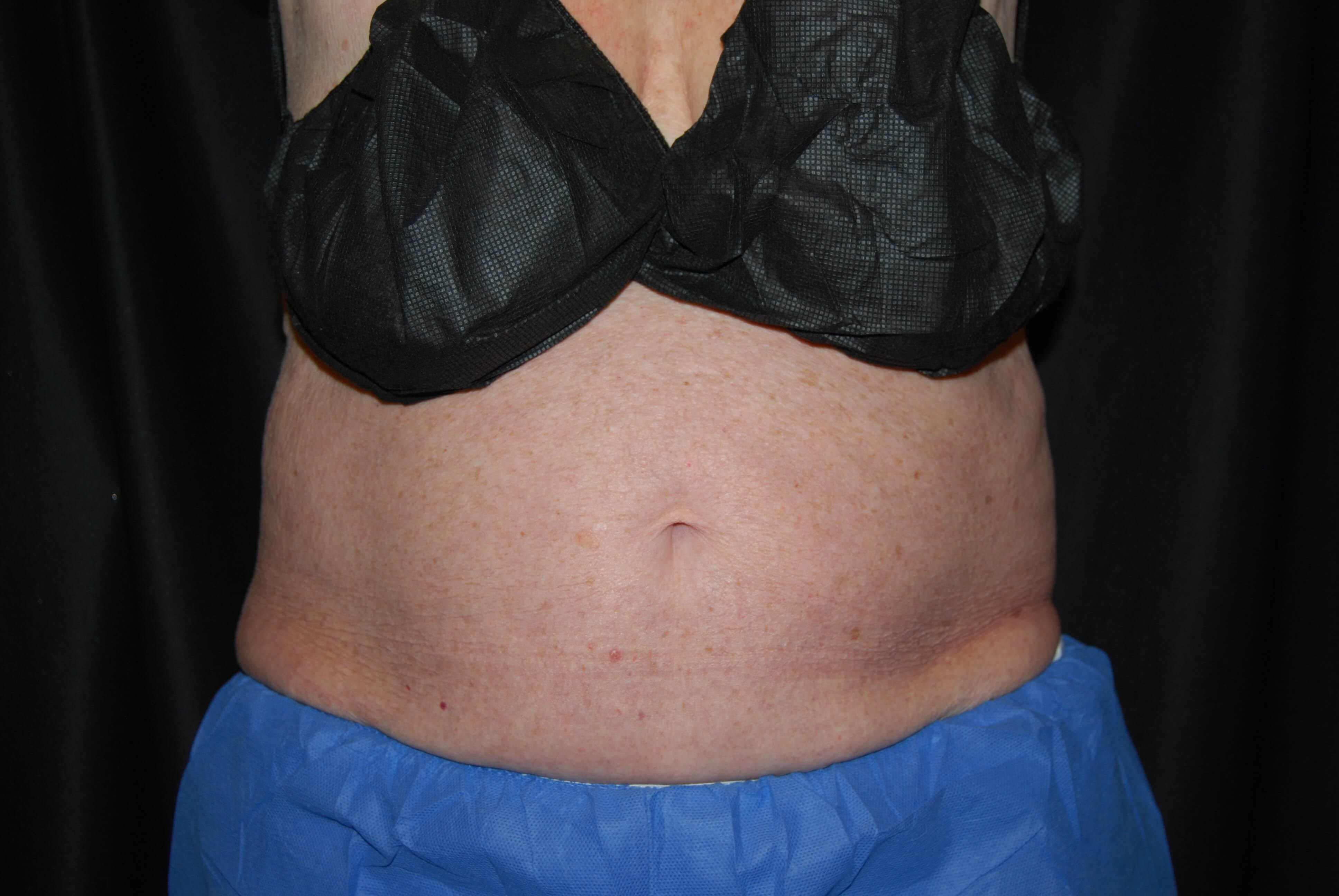 After Image