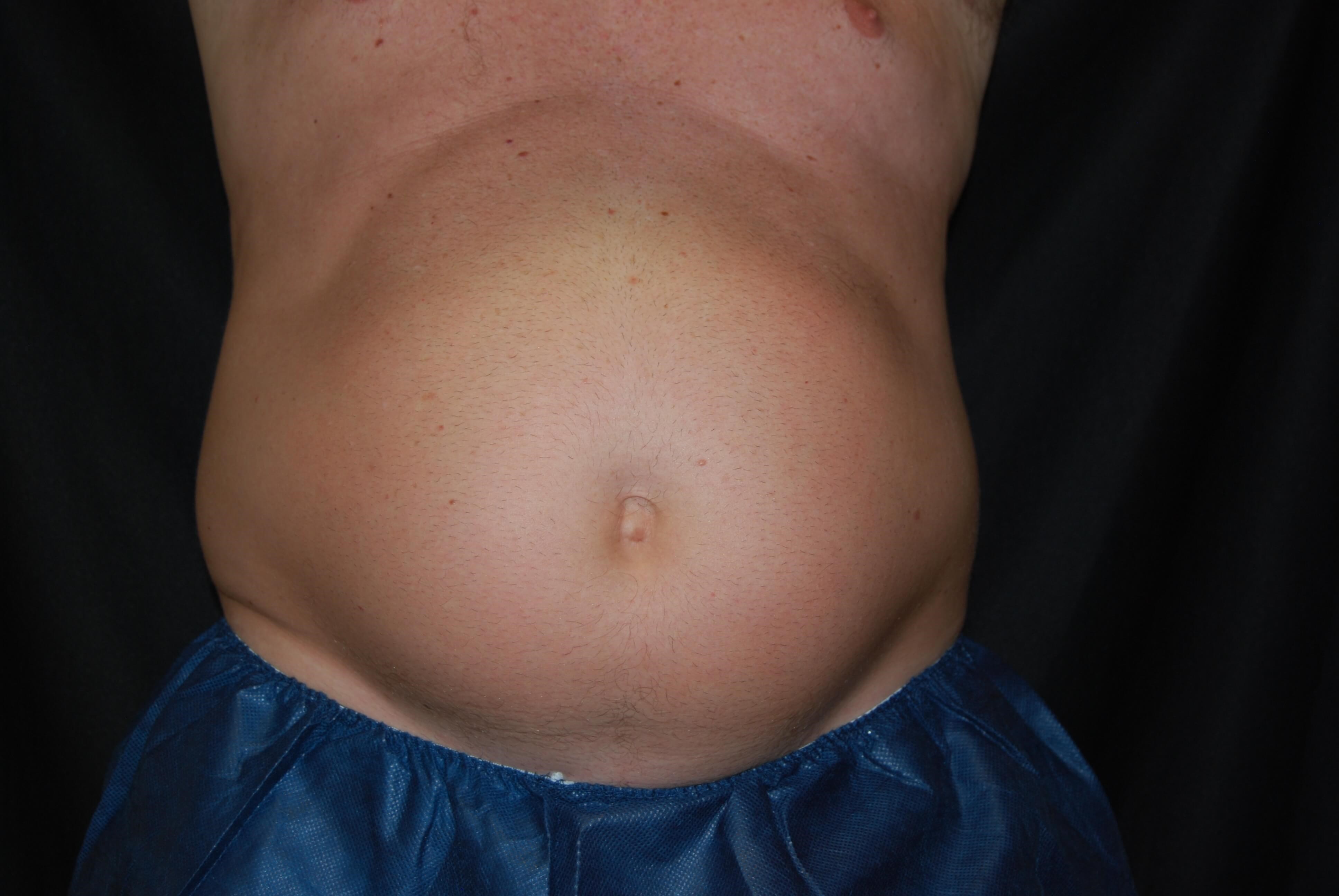 Before Image