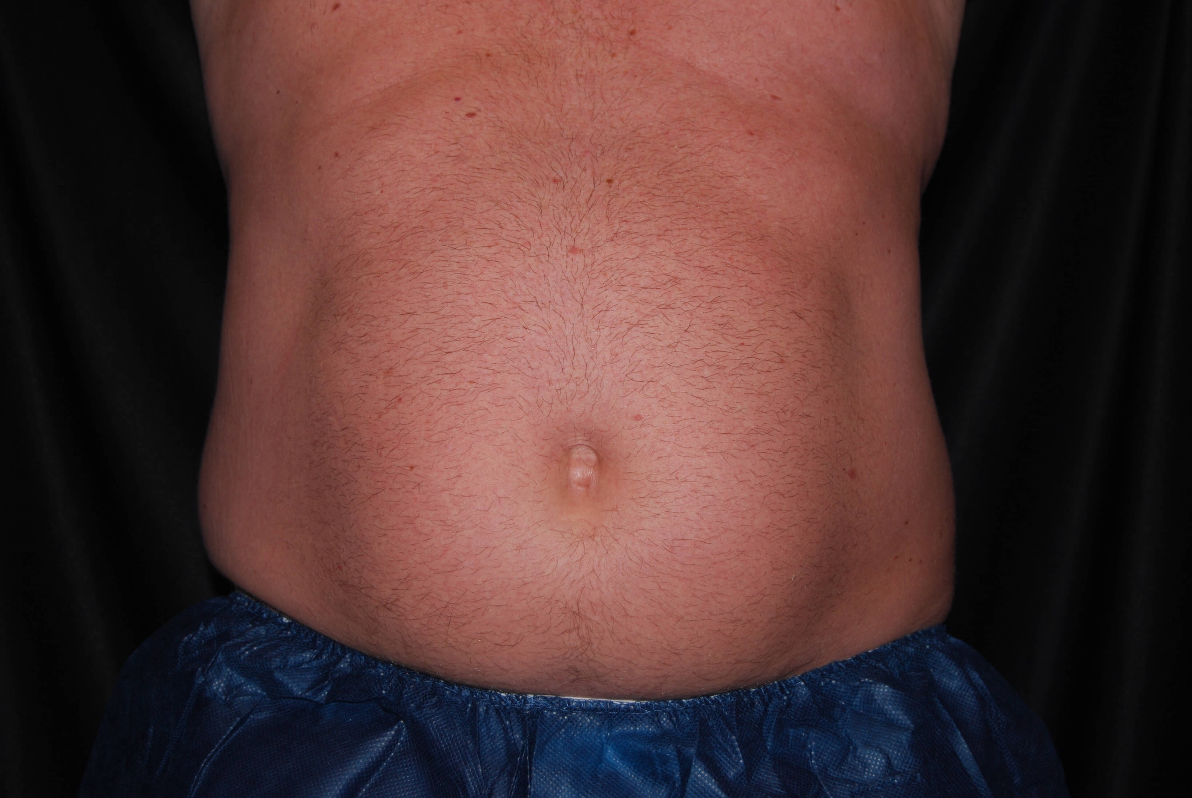 After Image