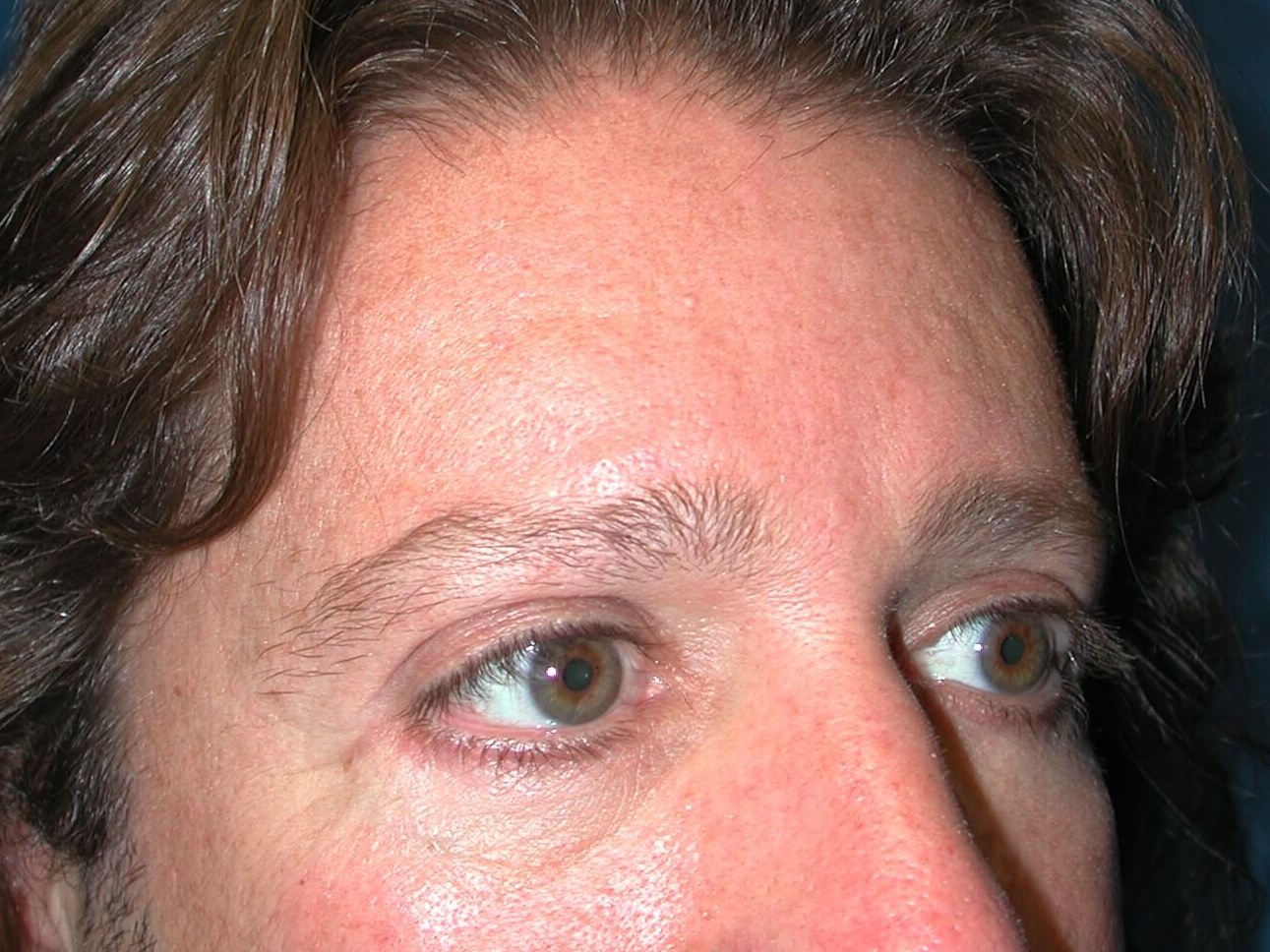 Right View After