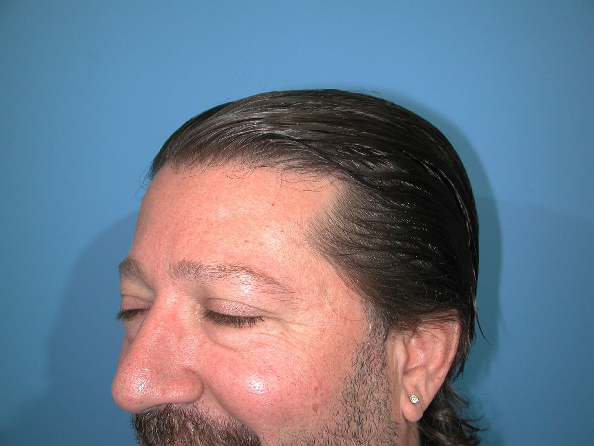 Left View Before