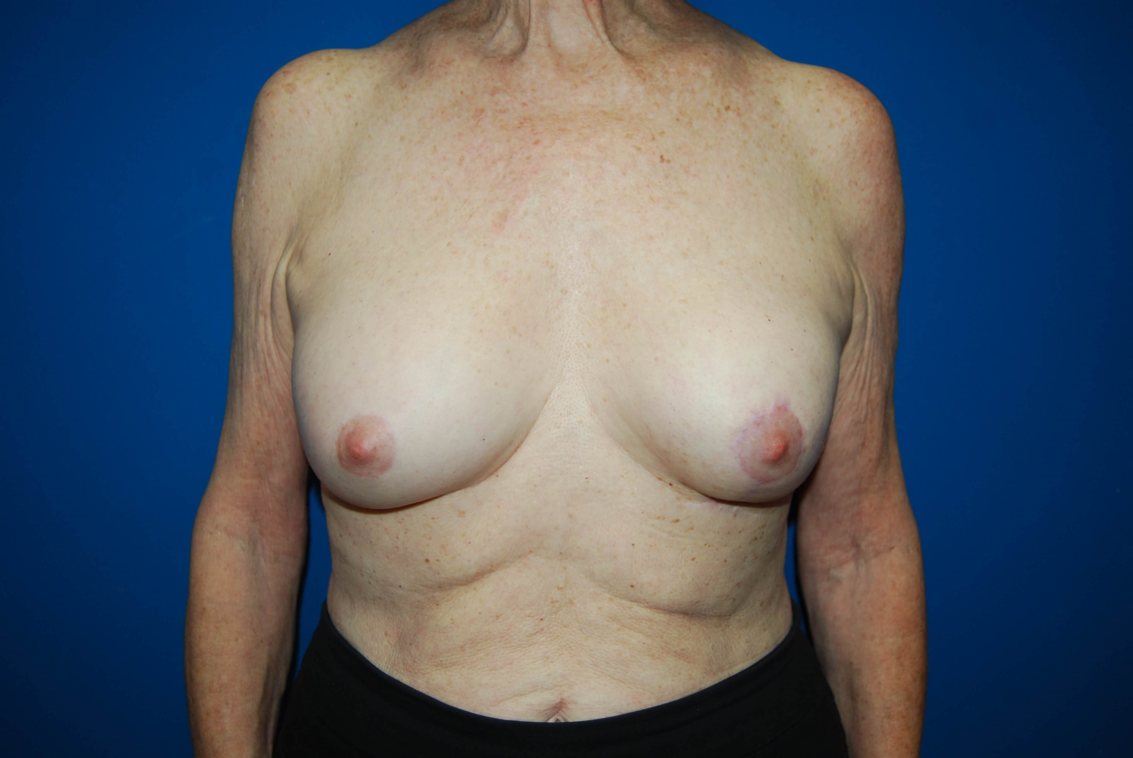 After Image
