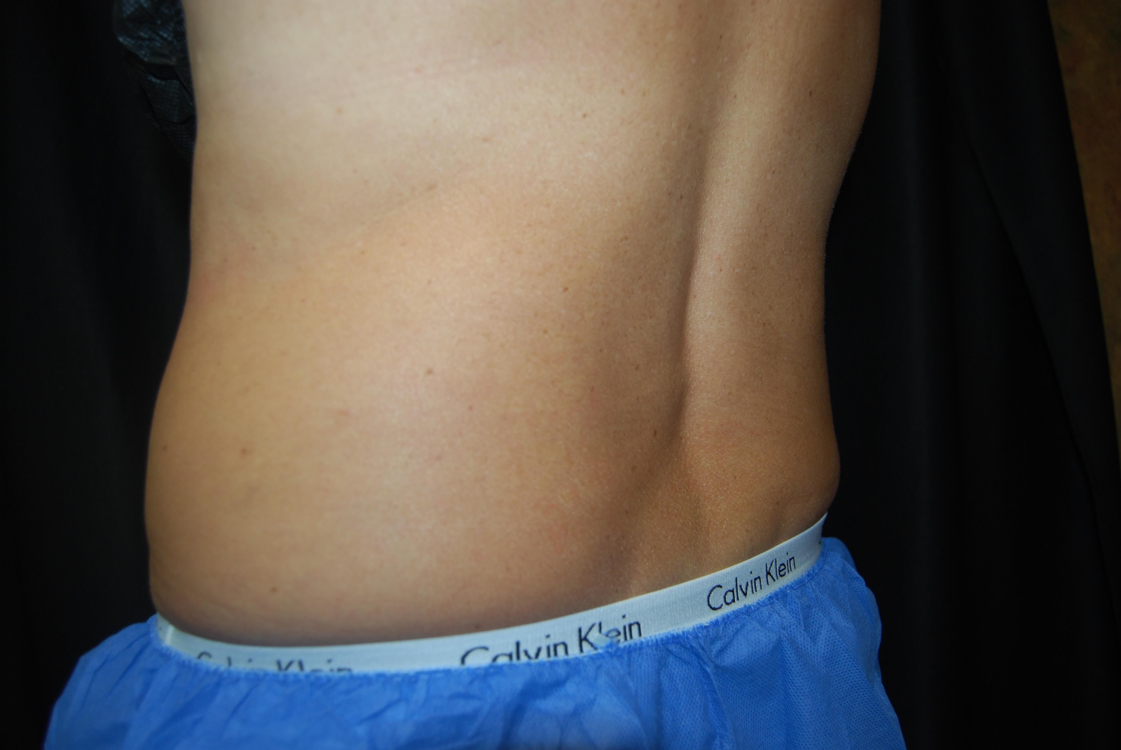 After Image