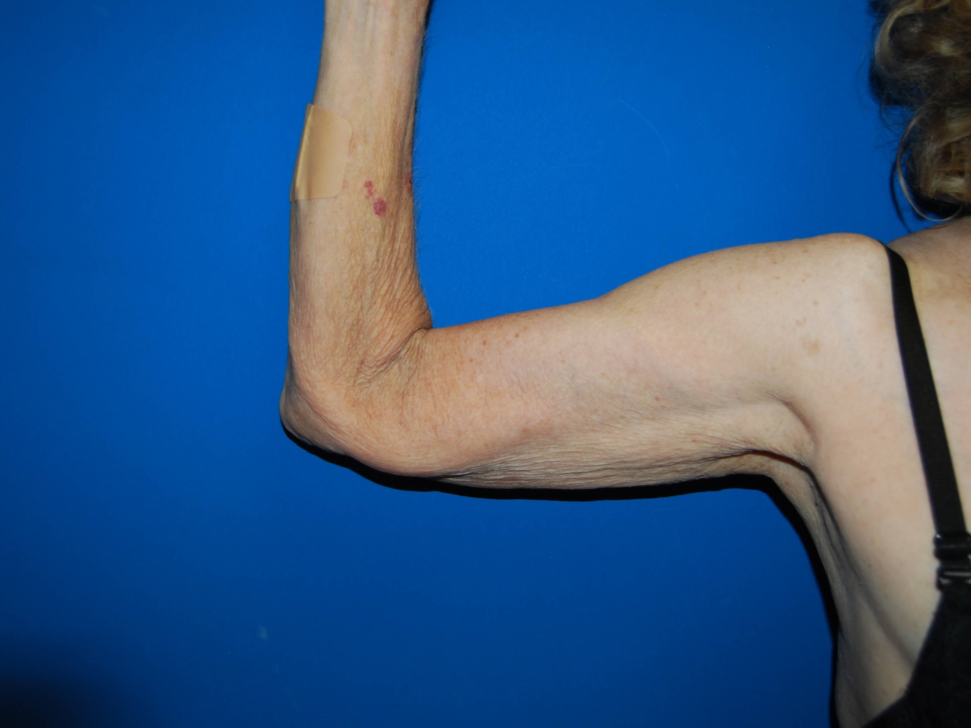 Inner View - Right Before Arm Lift