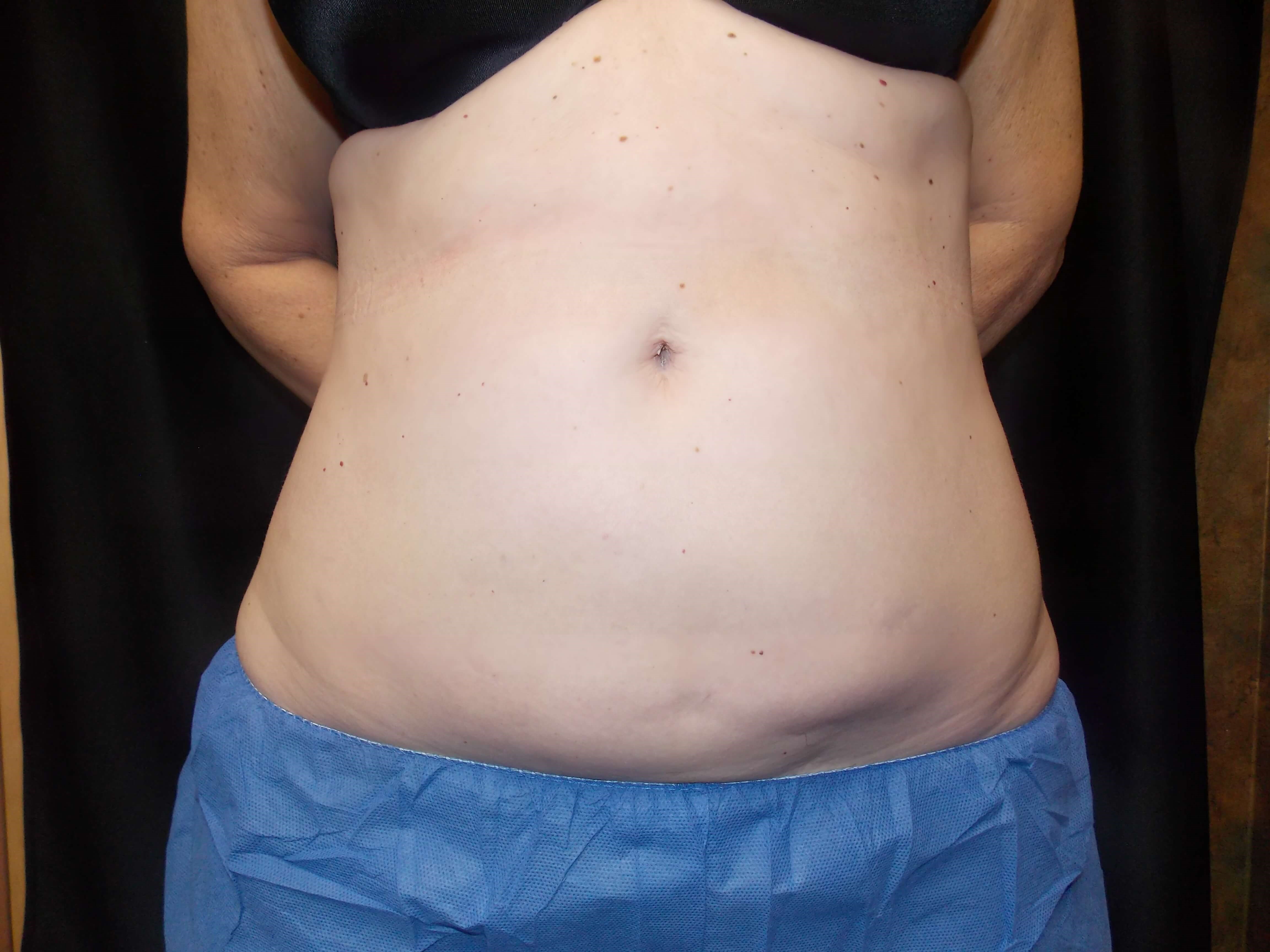 Before Image