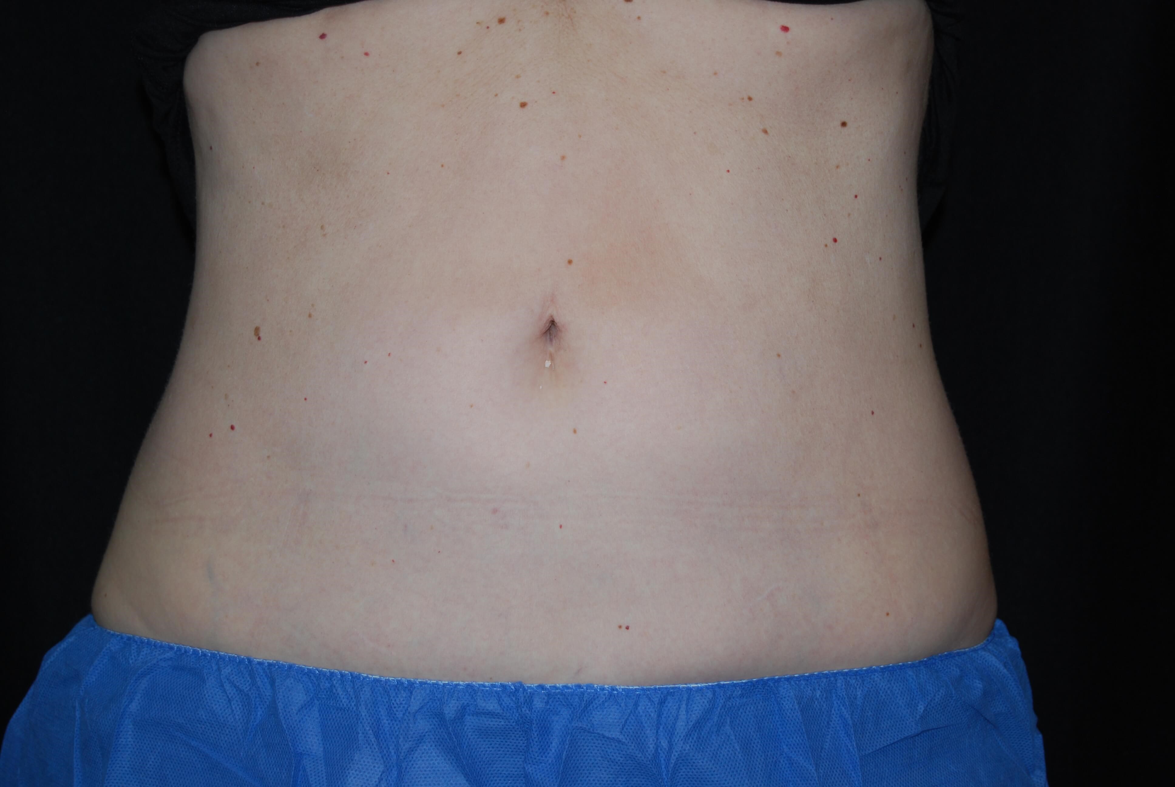 After Image