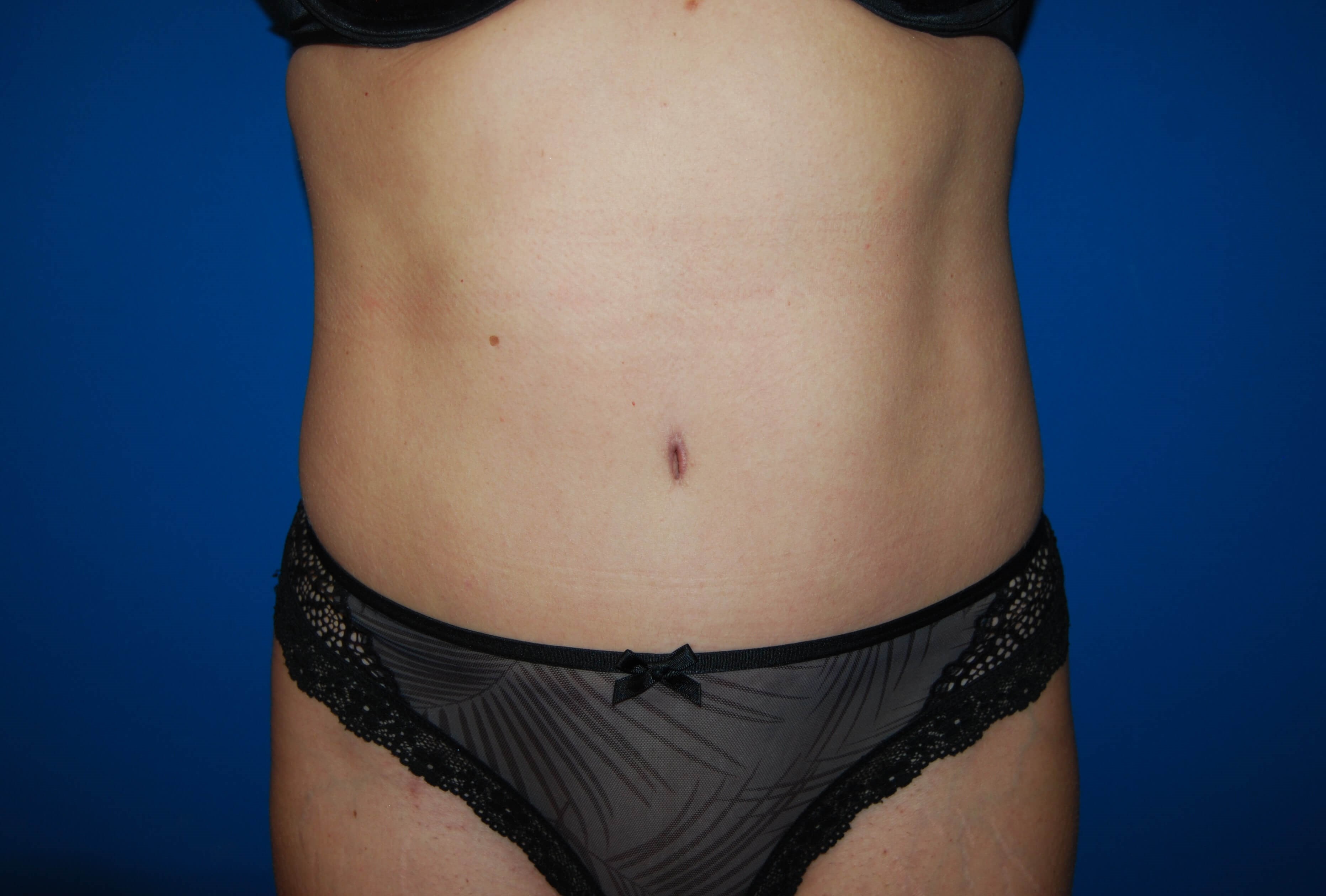 After Image
