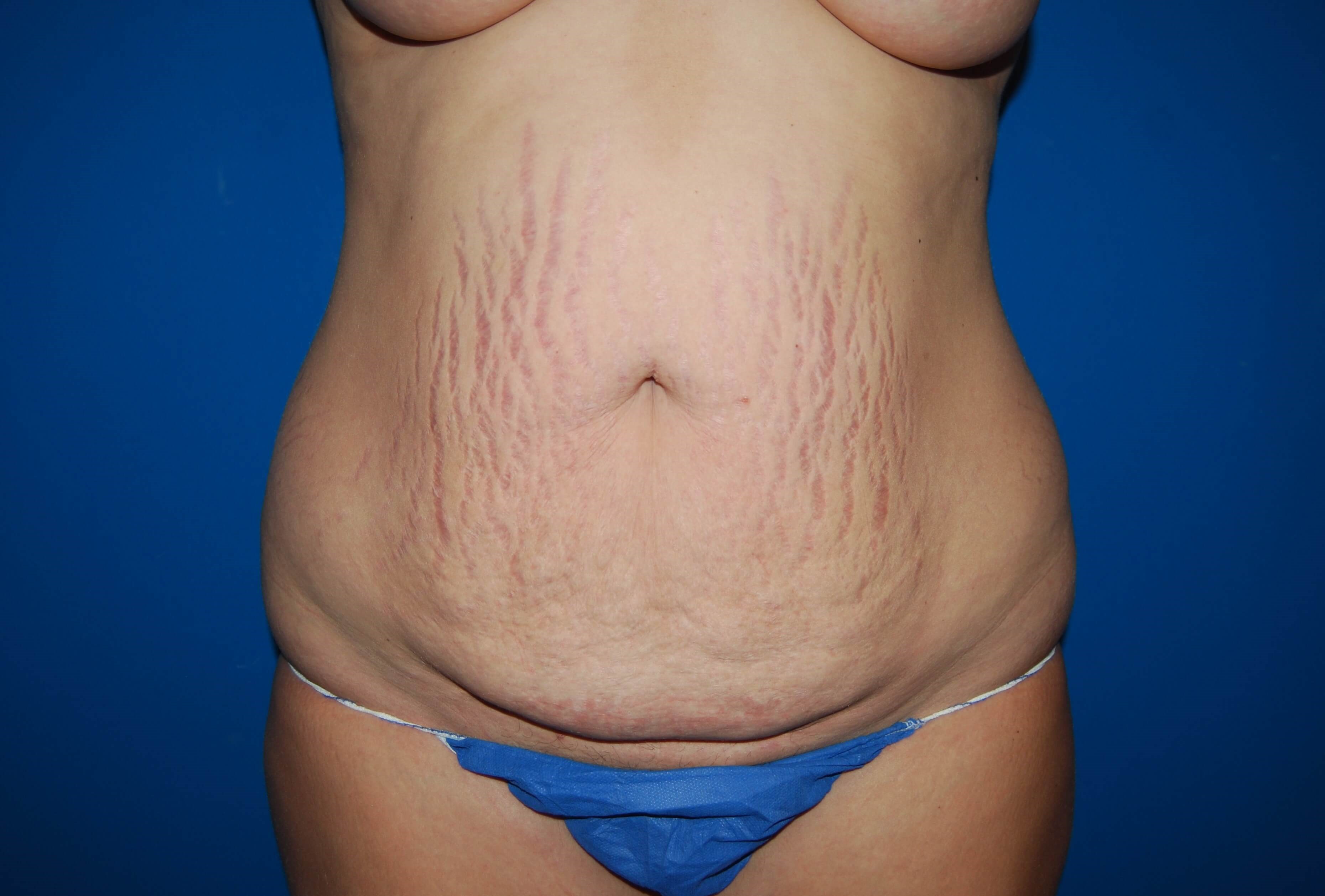 Before Image