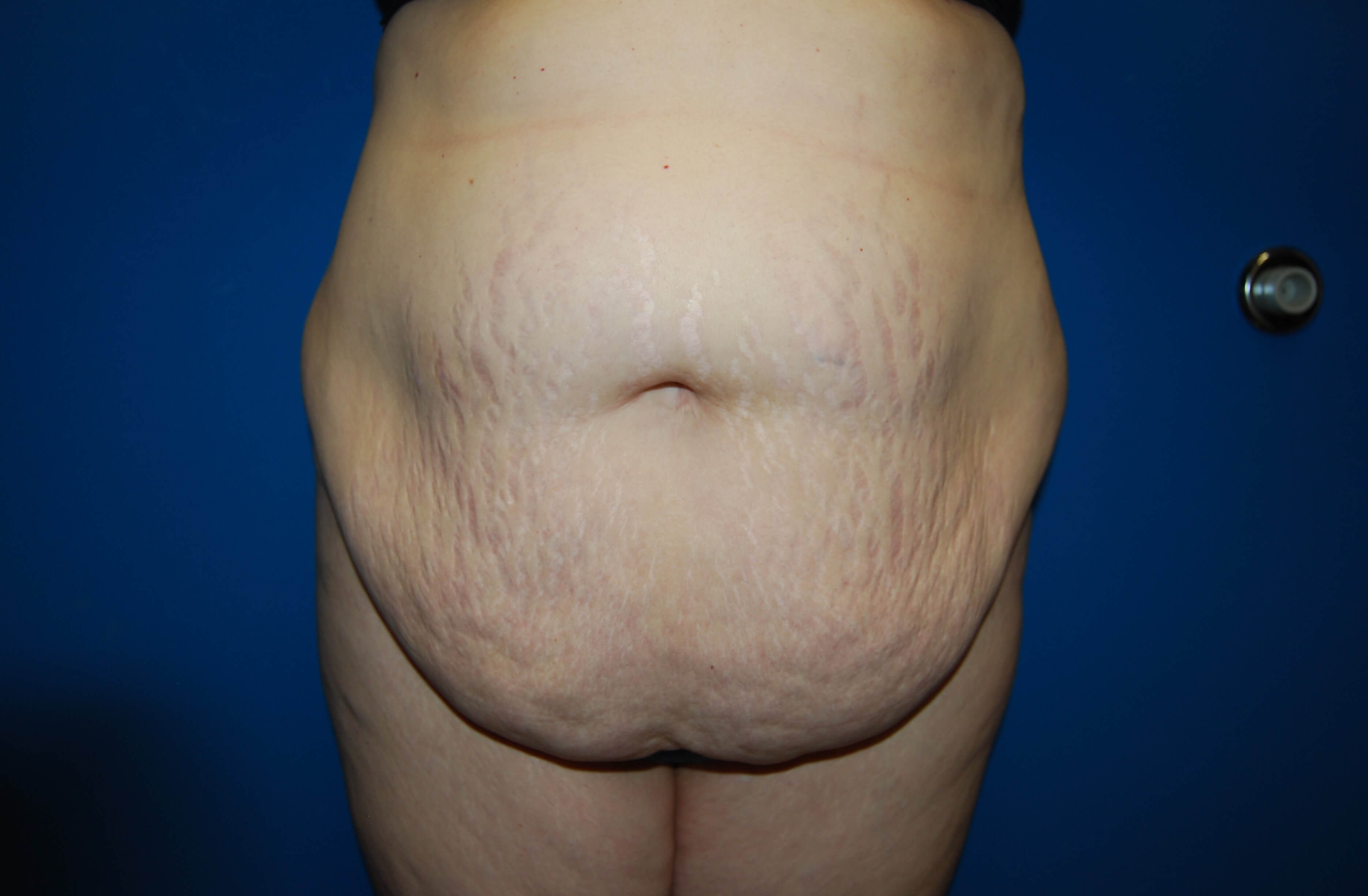 Before Image