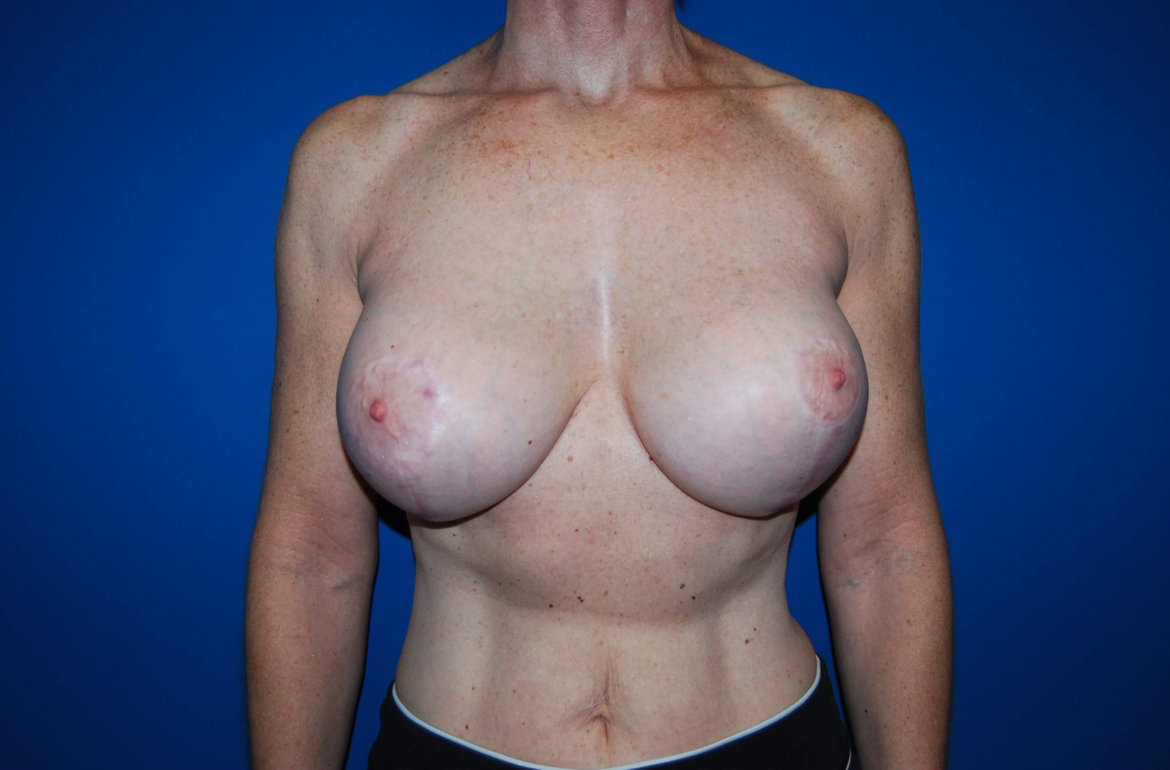 After Image