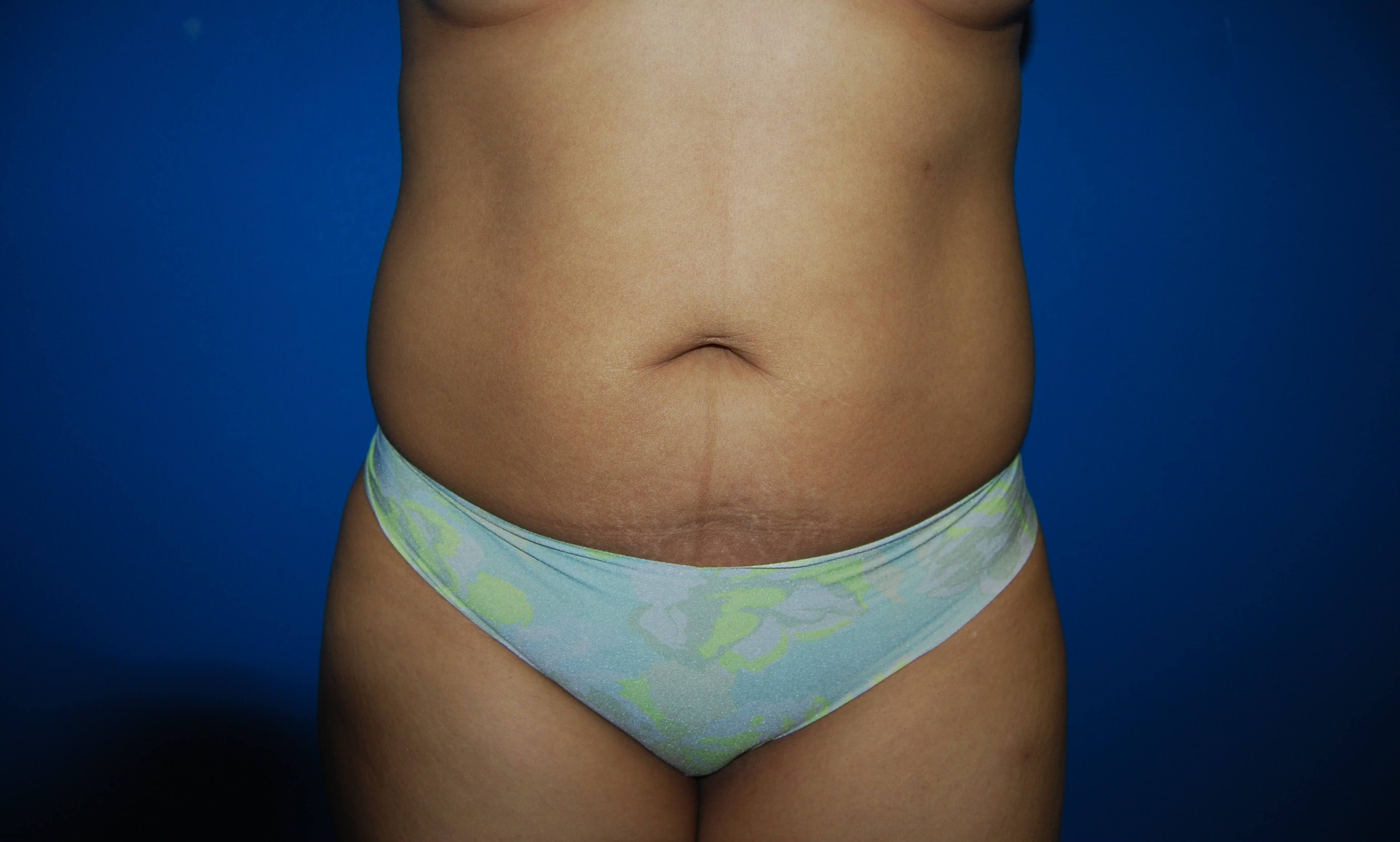 Before Image